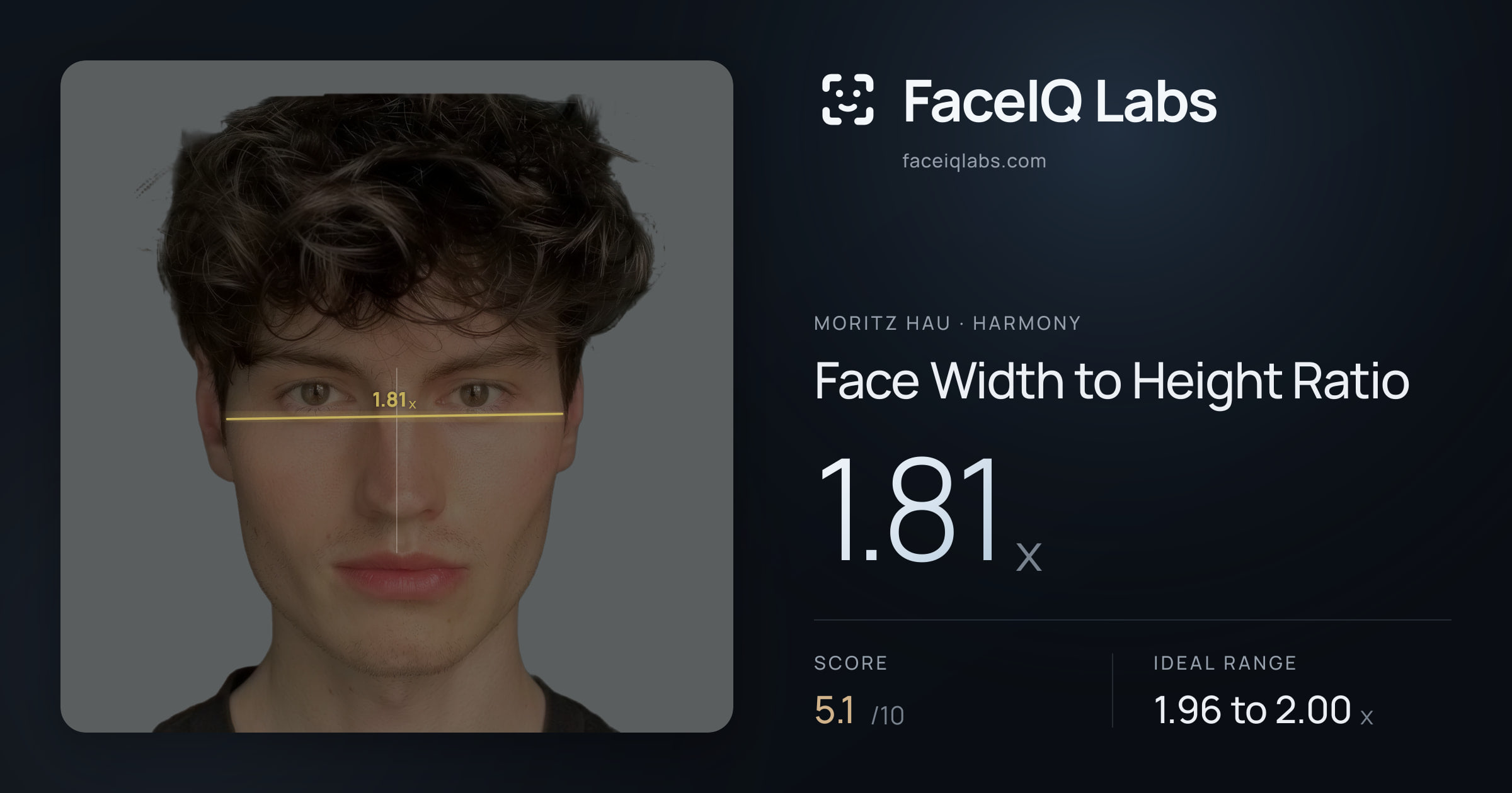 Moritz Hau Face Width to Height Ratio: 1.81x, drawn on the photo