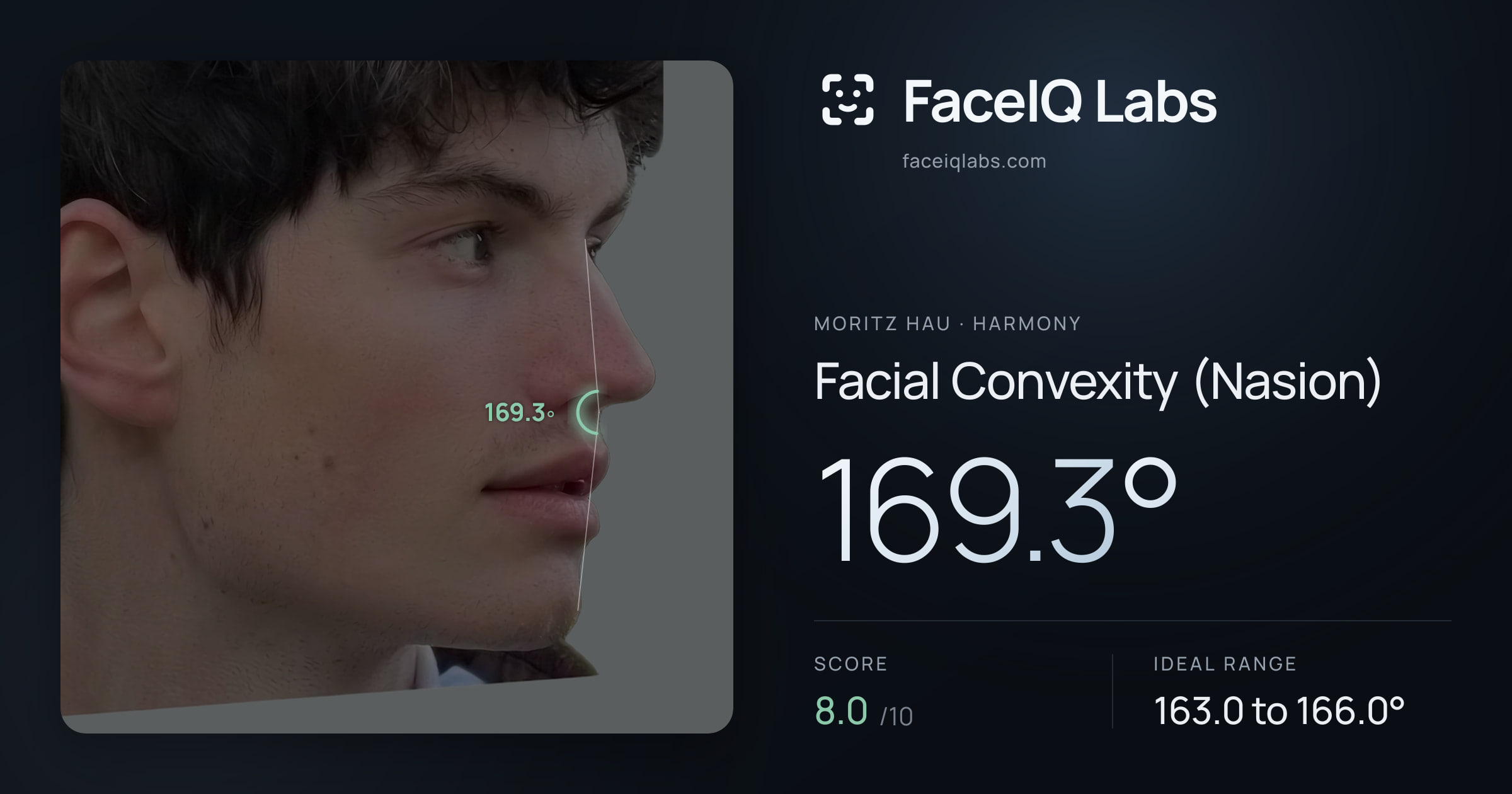 Moritz Hau Facial Convexity (Nasion): 169.3°, drawn on the photo