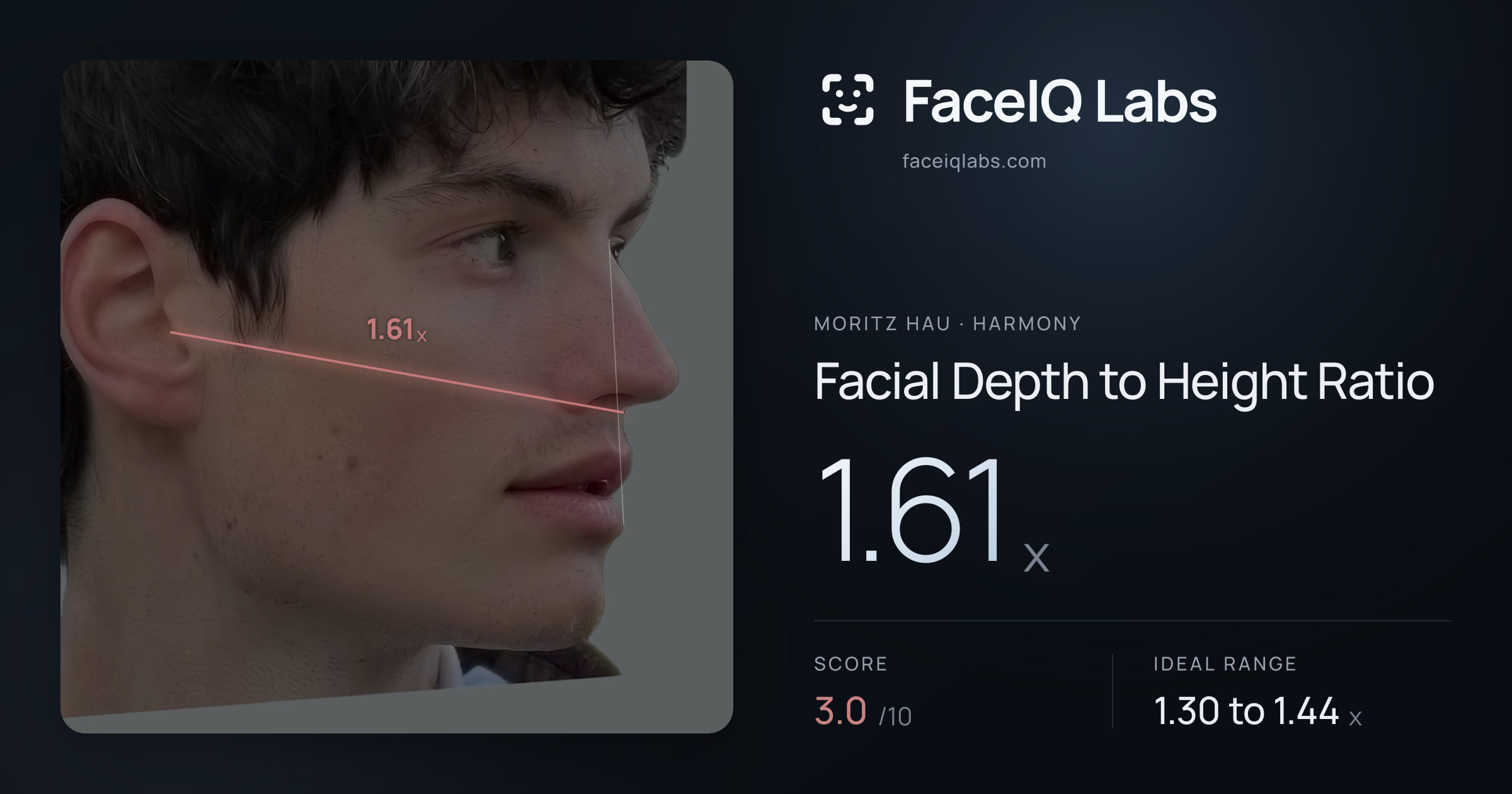 Moritz Hau Facial Depth to Height Ratio: 1.61x, drawn on the photo