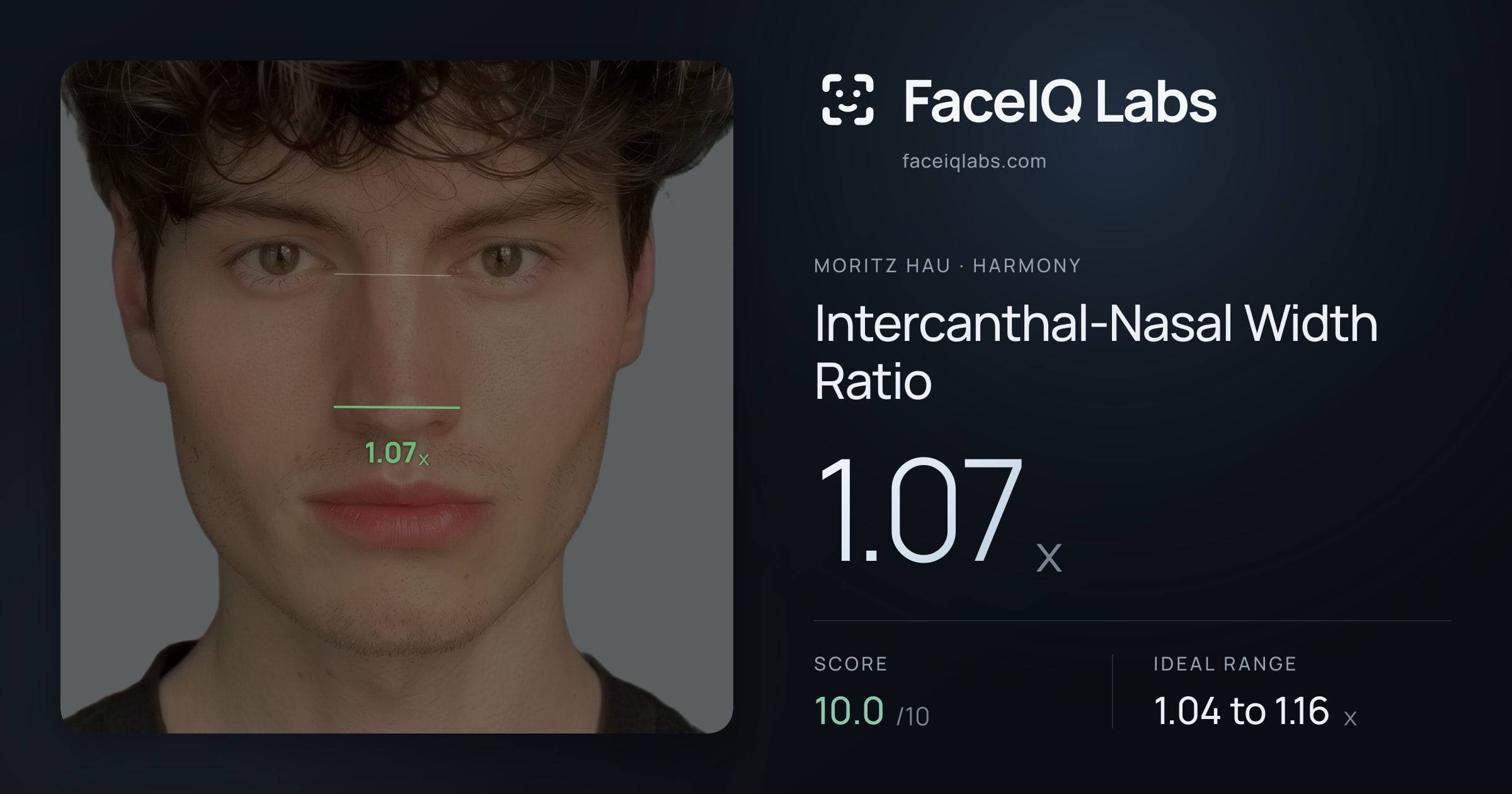 Moritz Hau Intercanthal-Nasal Width Ratio: 1.07x, drawn on the photo
