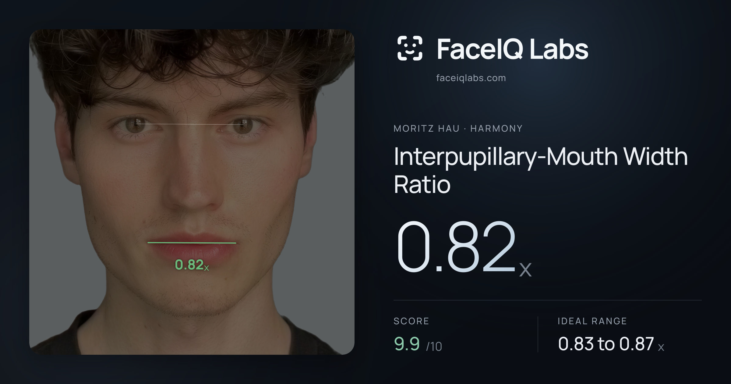 Moritz Hau Interpupillary-Mouth Width Ratio: 0.82x, drawn on the photo
