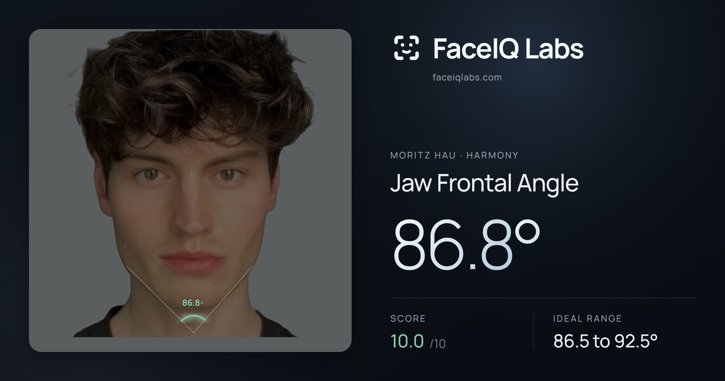 Moritz Hau Jaw Frontal Angle: 86.8°, drawn on the photo