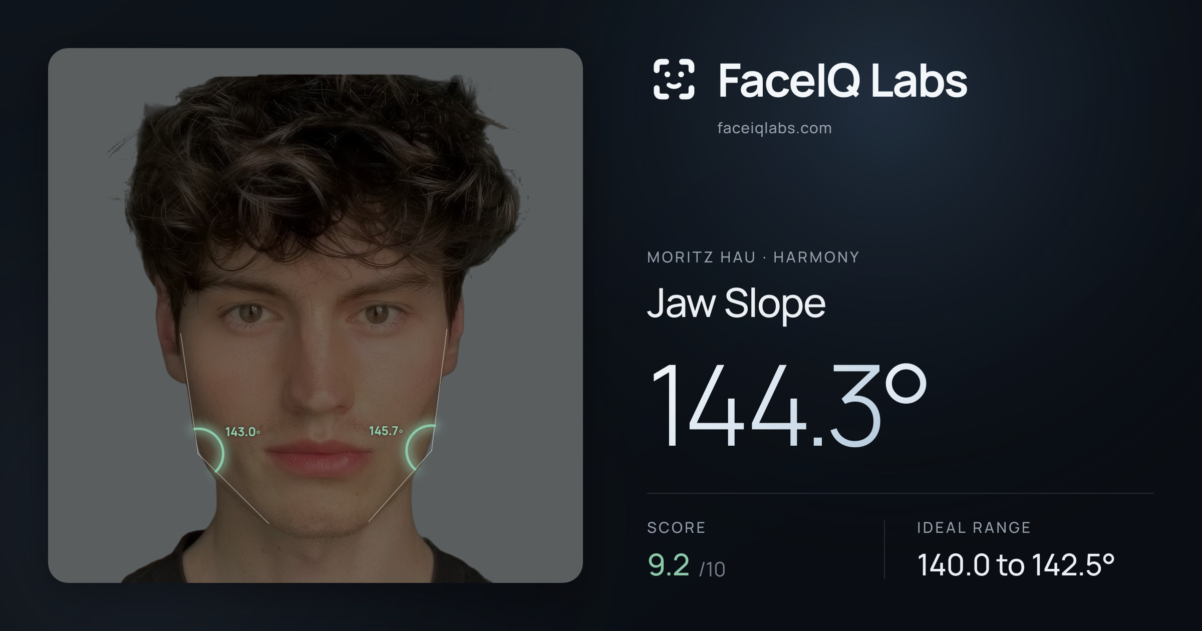 Moritz Hau Jaw Slope: 144.3°, drawn on the photo