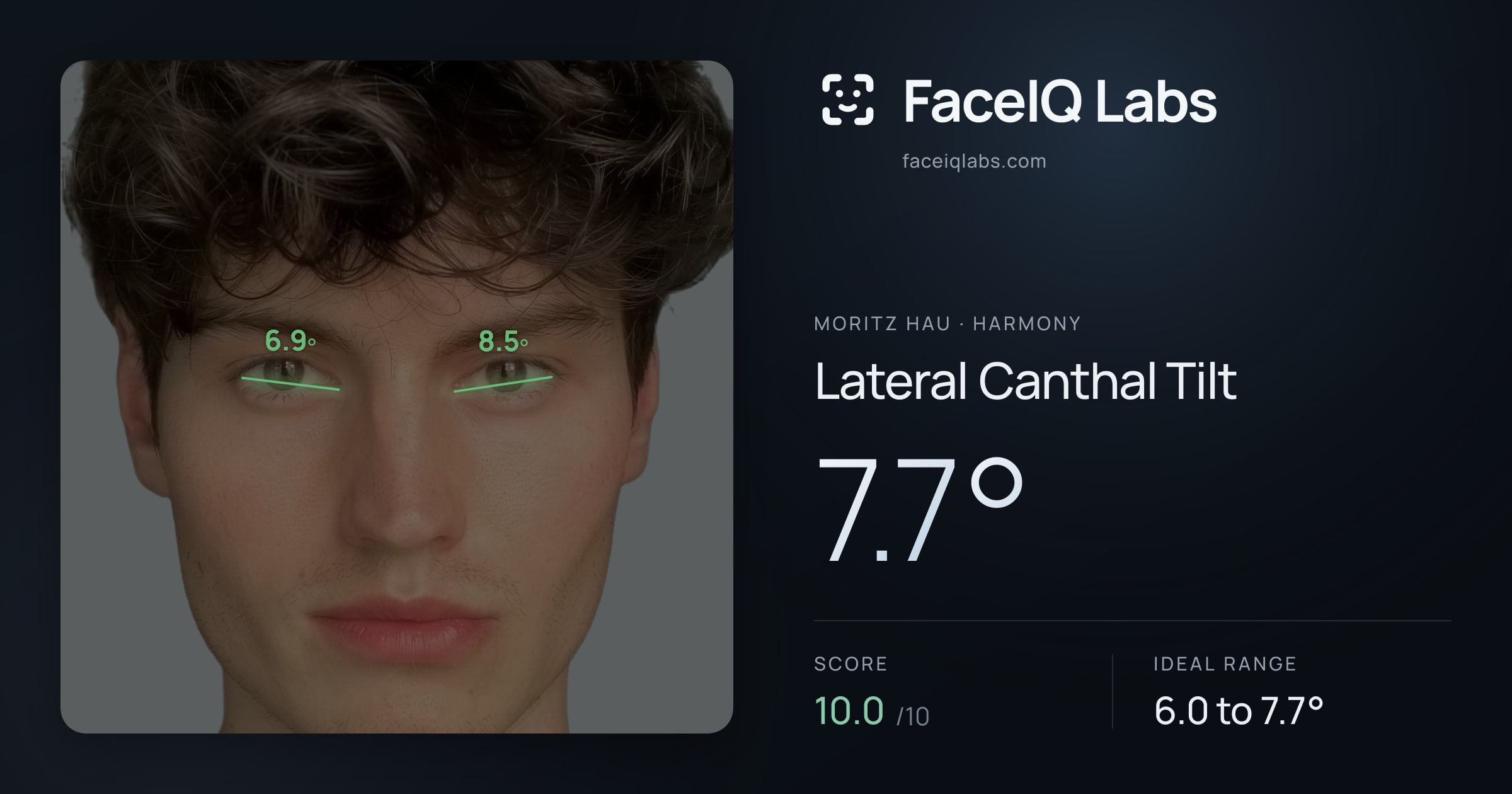 Moritz Hau Lateral Canthal Tilt: 7.7°, drawn on the photo