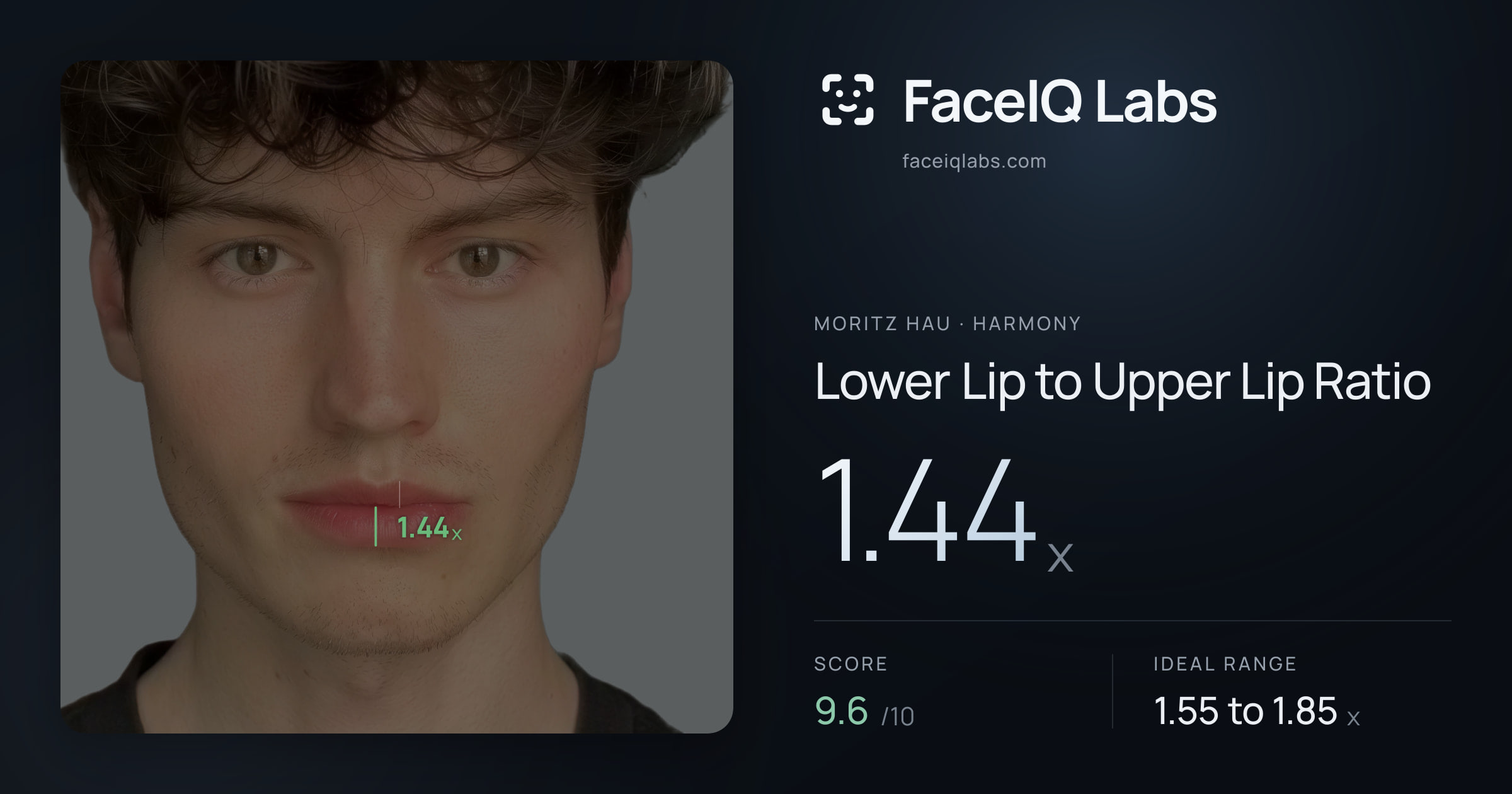 Moritz Hau Lower Lip to Upper Lip Ratio: 1.44x, drawn on the photo