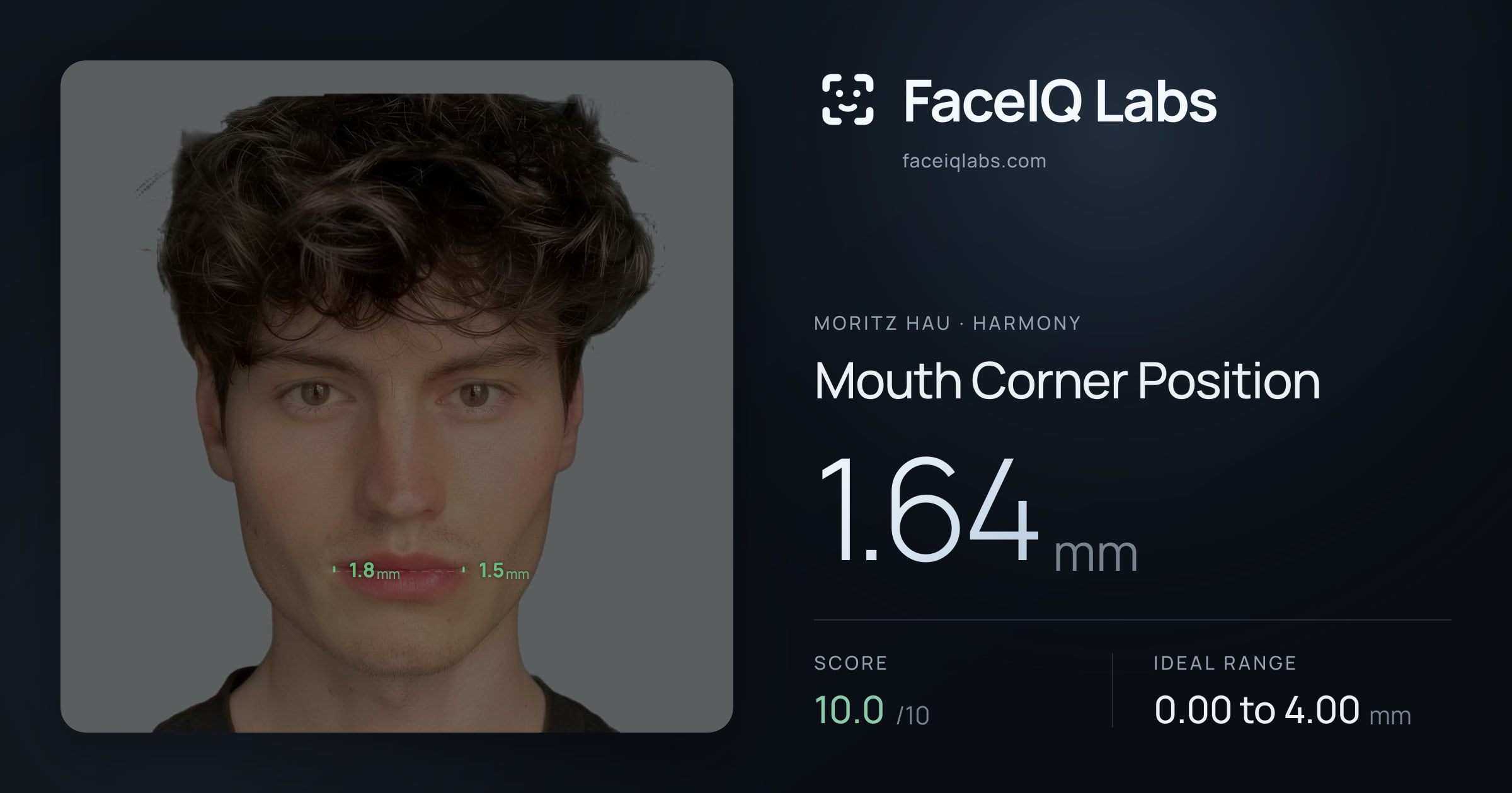 Moritz Hau Mouth Corner Position: 1.64mm, drawn on the photo