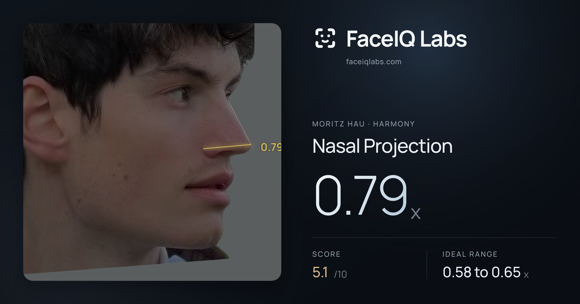 Moritz Hau Nasal Projection: 0.79x, drawn on the photo