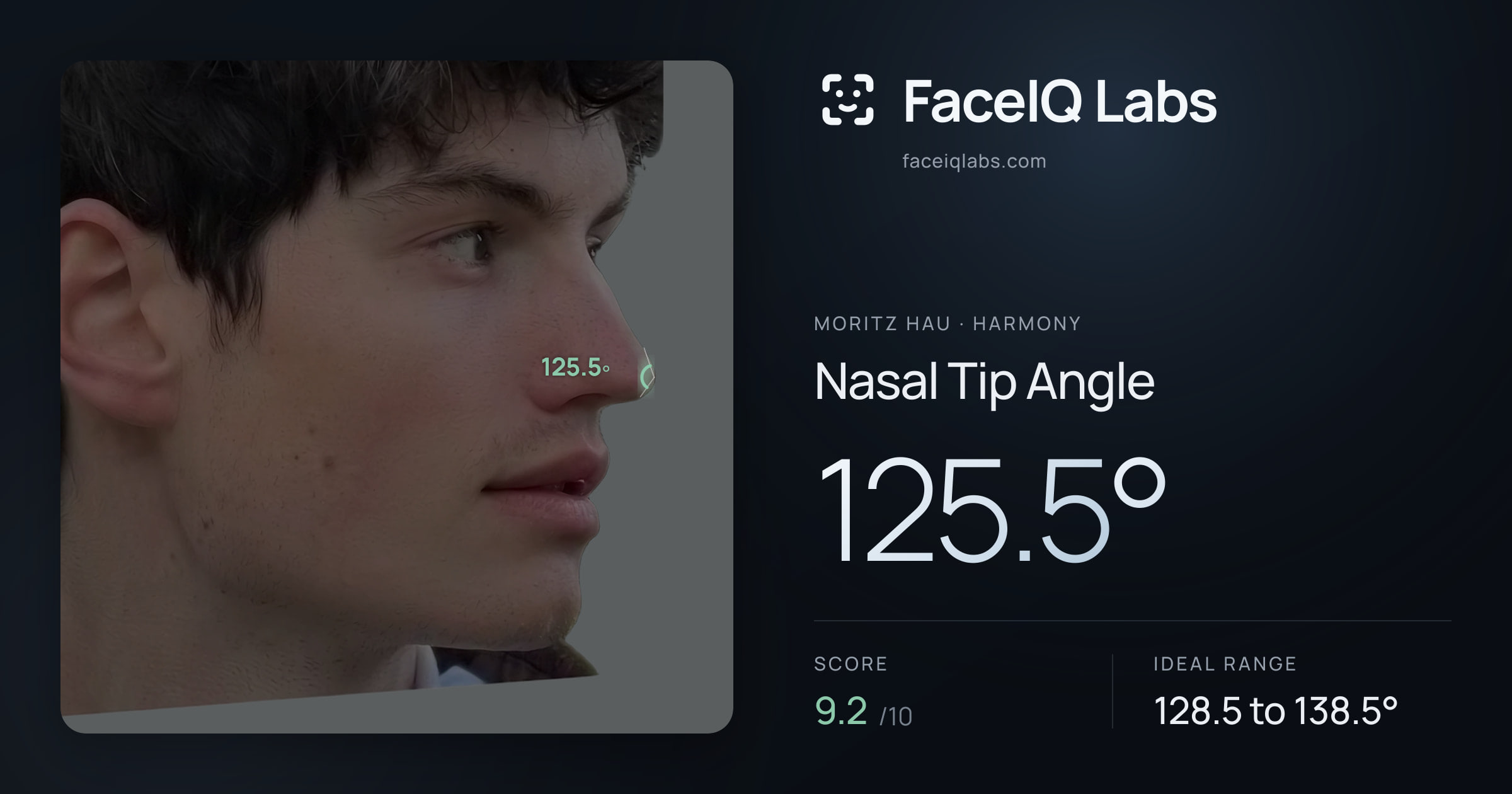 Moritz Hau Nasal Tip Angle: 125.5°, drawn on the photo