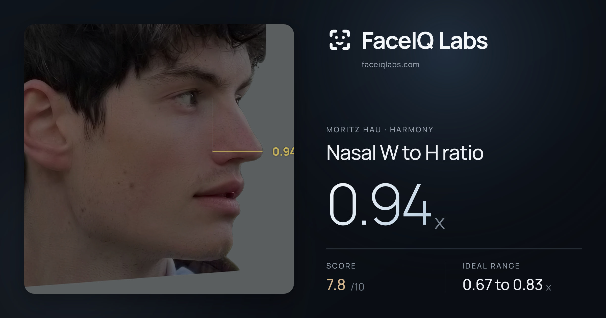 Moritz Hau Nasal W to H ratio: 0.94x, drawn on the photo