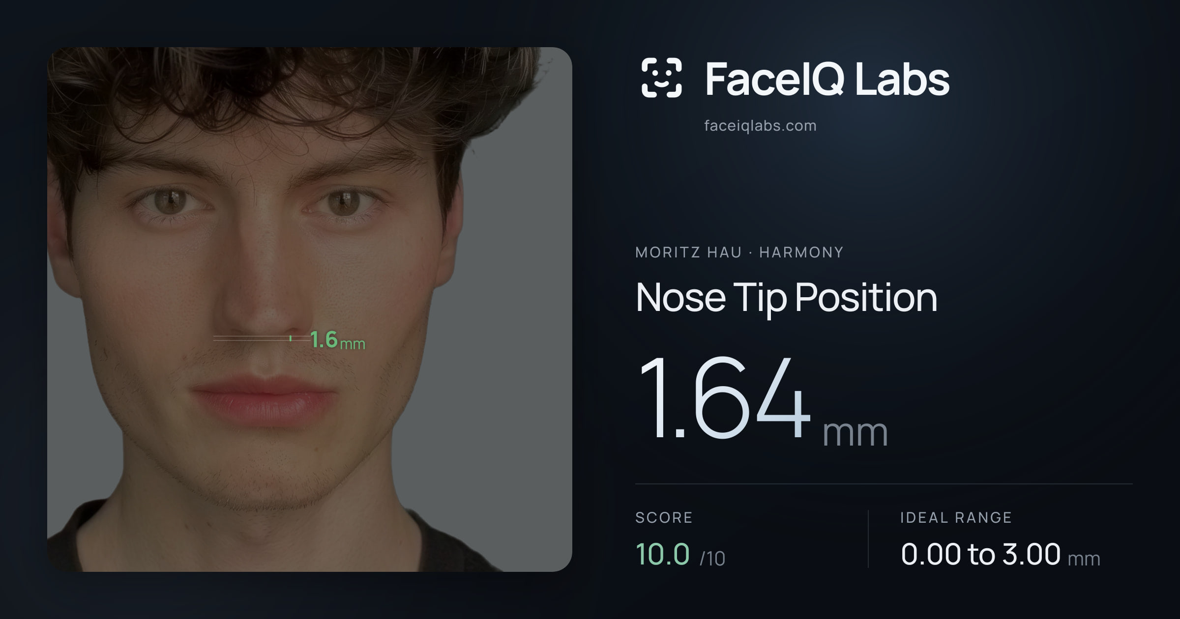 Moritz Hau Nose Tip Position: 1.64mm, drawn on the photo