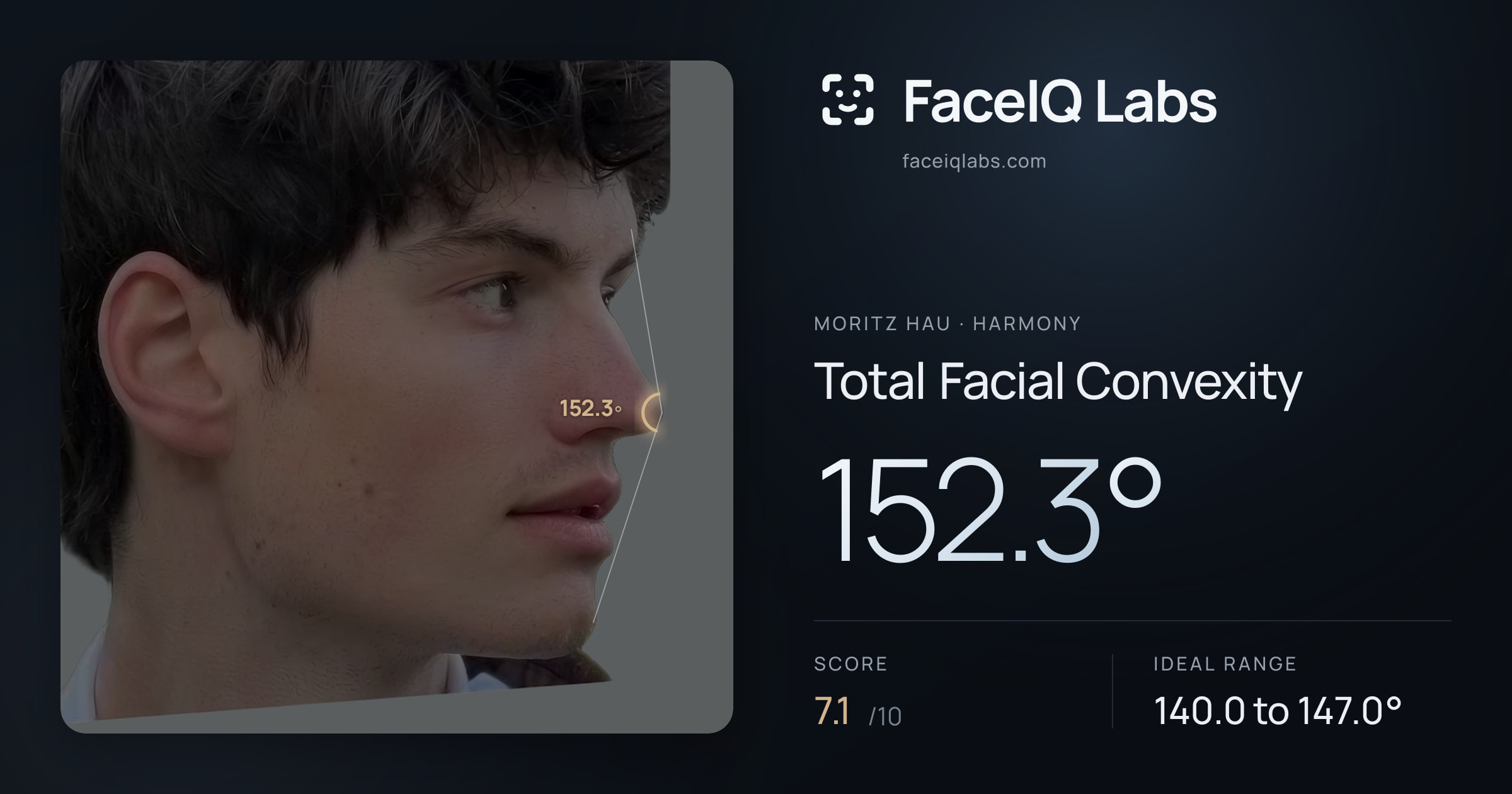 Moritz Hau Total Facial Convexity: 152.3°, drawn on the photo
