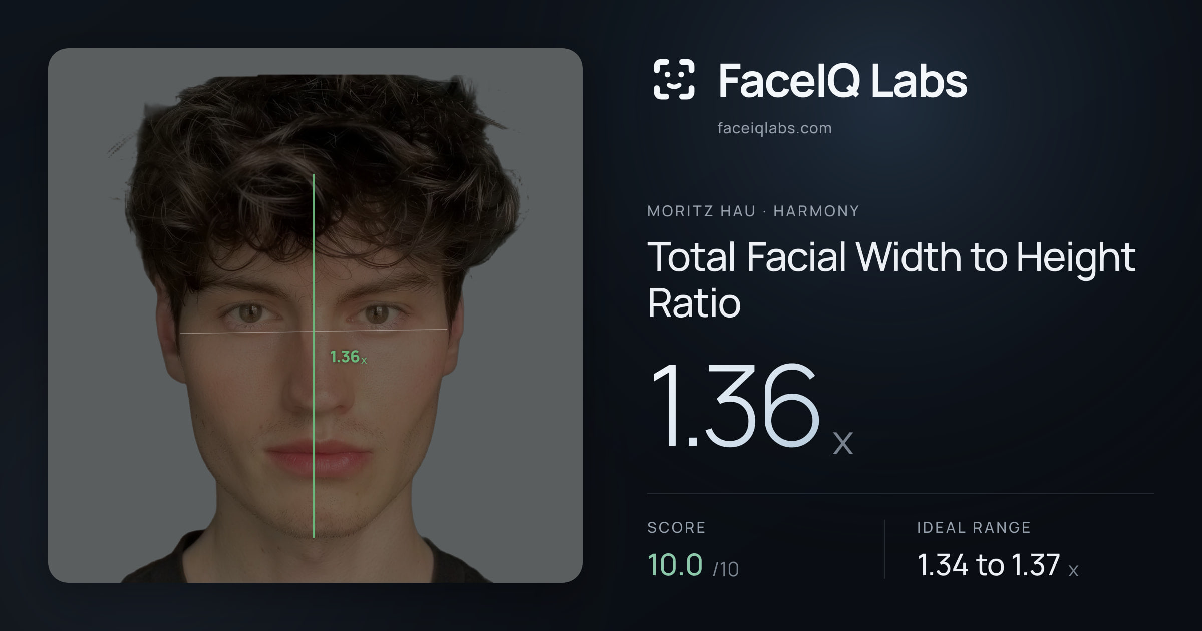 Moritz Hau Total Facial Width to Height Ratio: 1.36x, drawn on the photo
