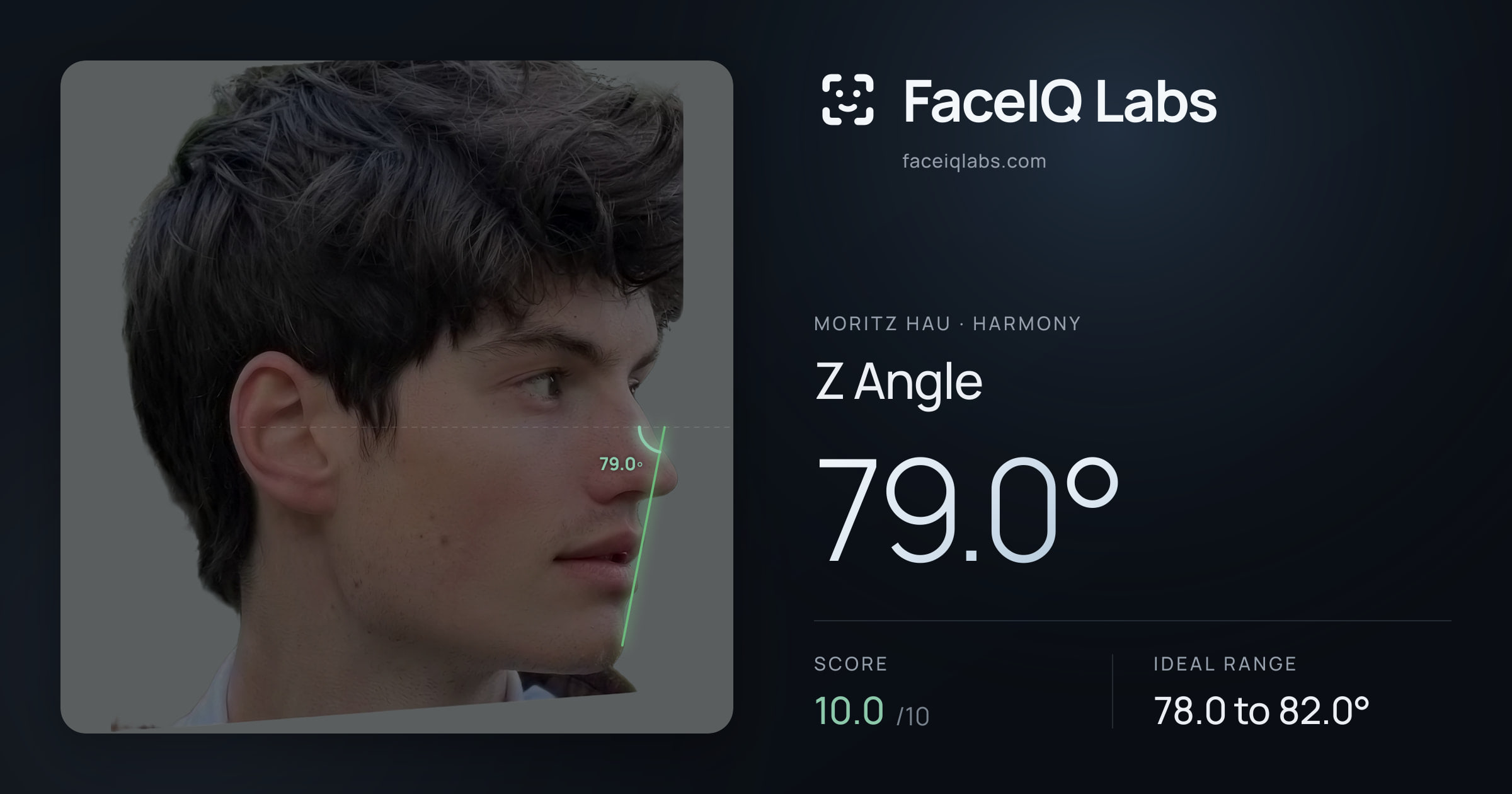 Moritz Hau Z Angle: 79.0°, drawn on the photo