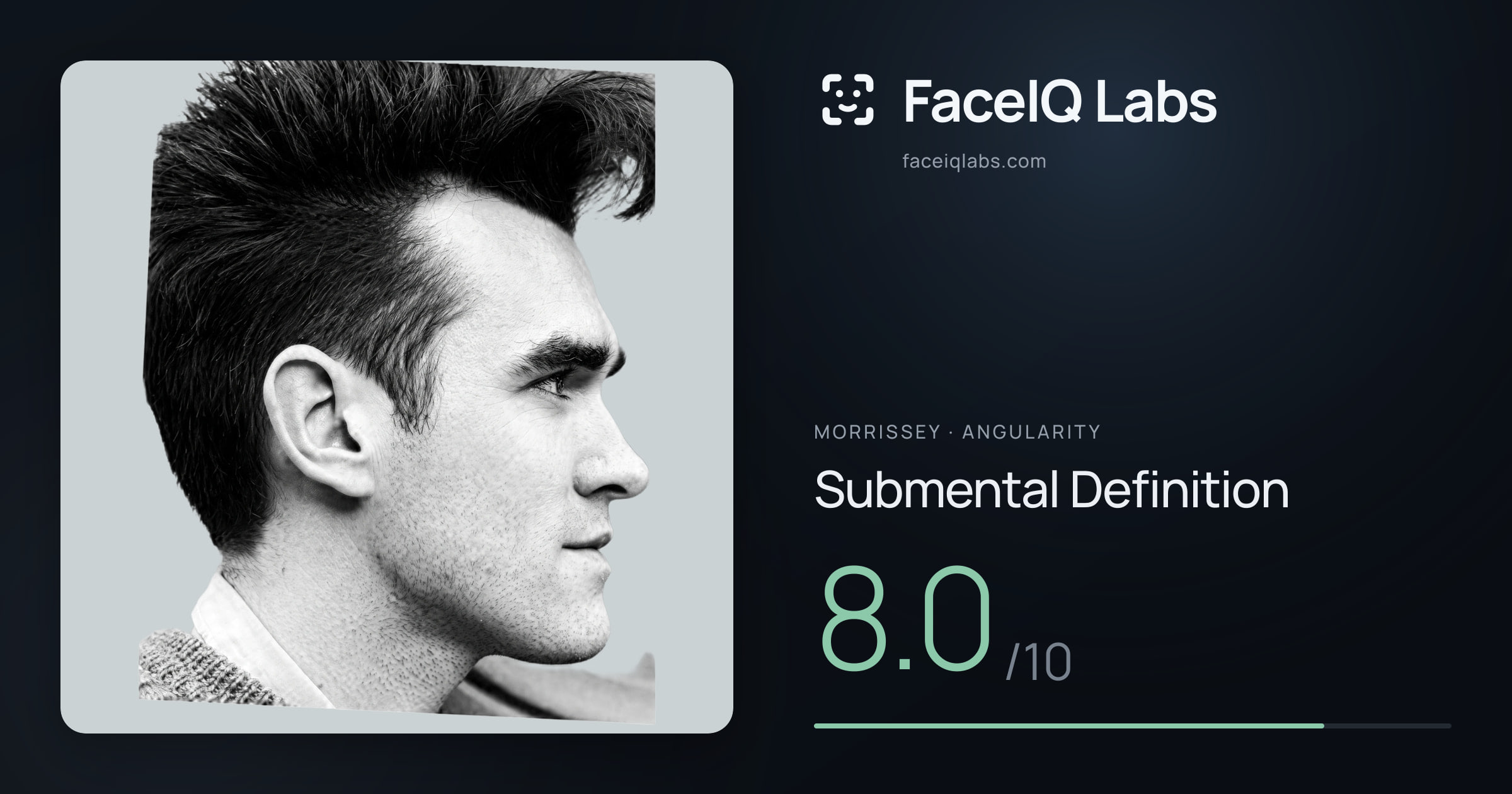 Morrissey Submental Definition: 8.0/10, drawn on the photo