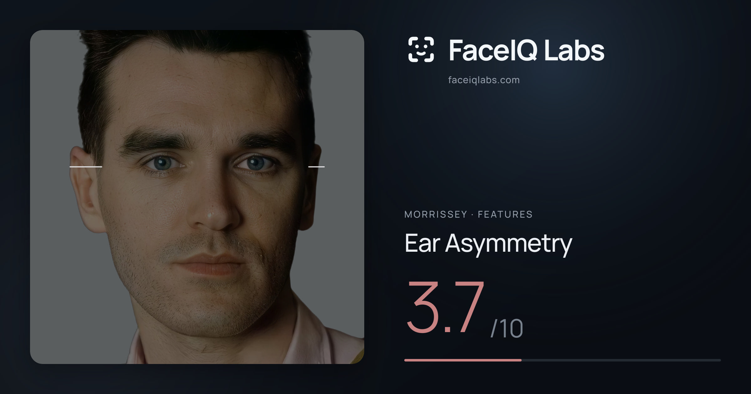Morrissey Ear Asymmetry: 3.7/10, drawn on the photo