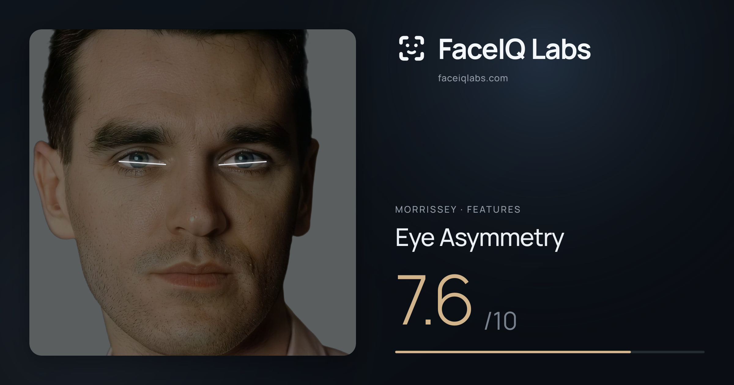 Morrissey Eye Asymmetry: 7.6/10, drawn on the photo