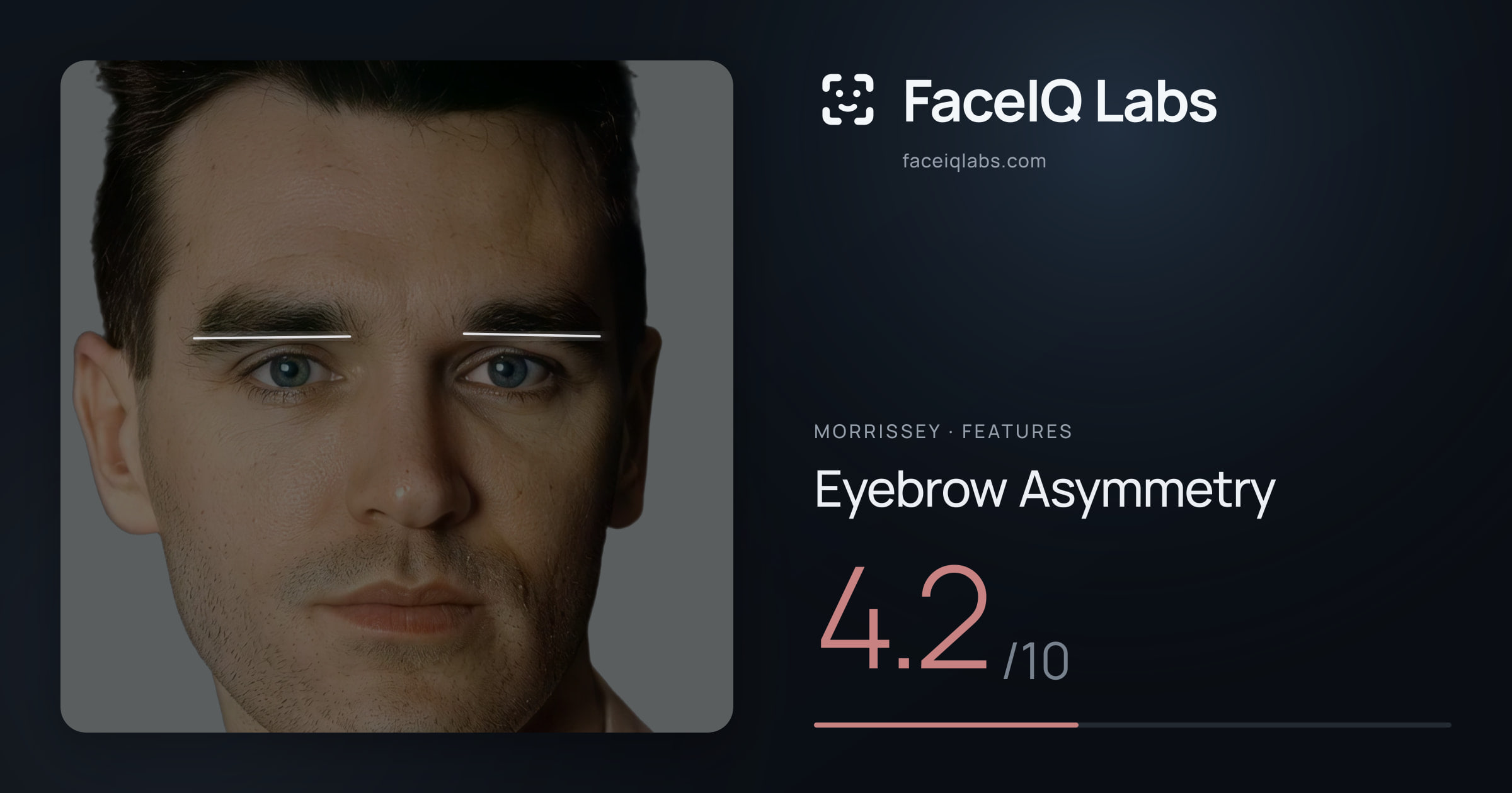 Morrissey Eyebrow Asymmetry: 4.2/10, drawn on the photo