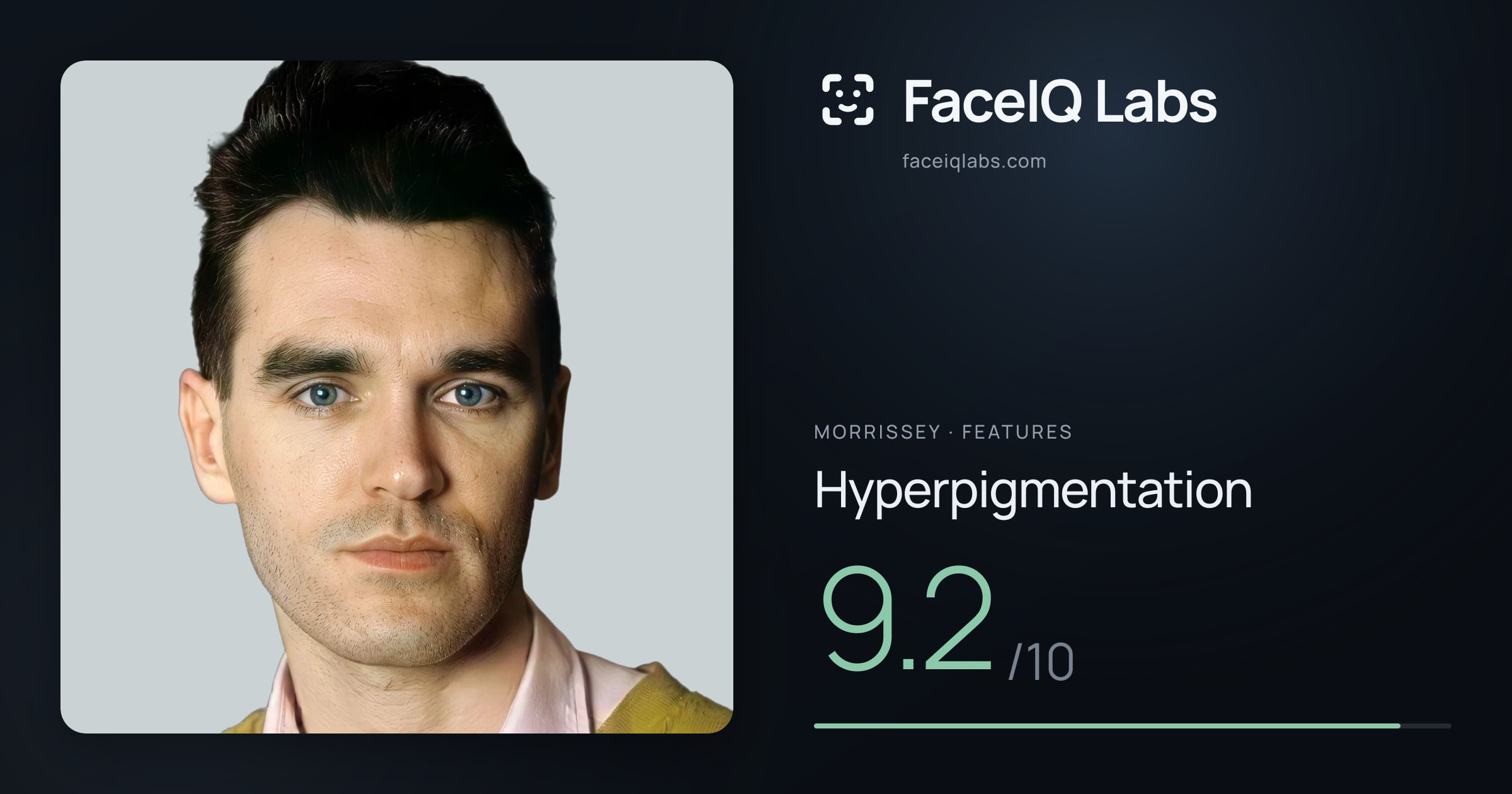 Morrissey Hyperpigmentation: 9.2/10, drawn on the photo