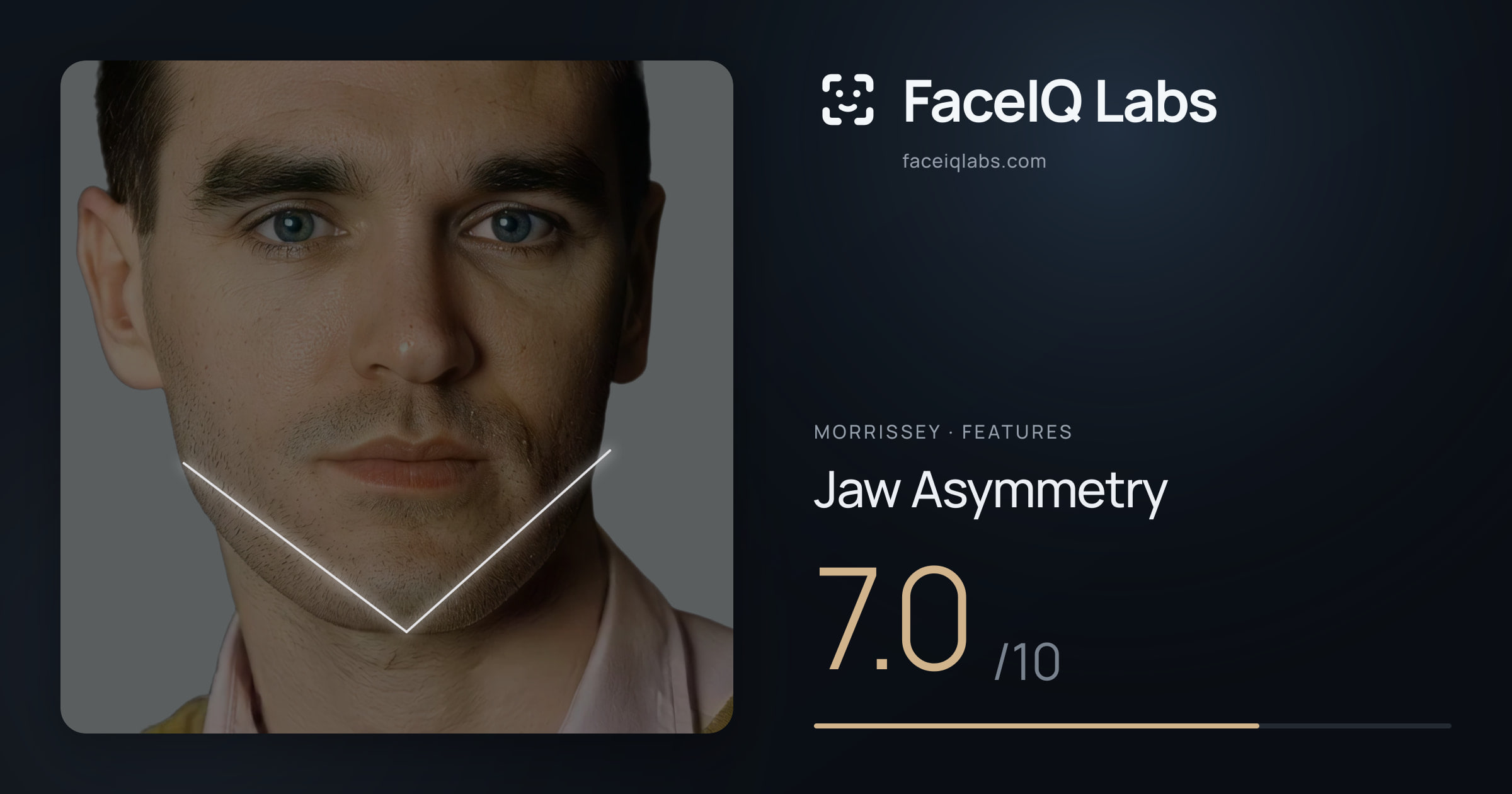 Morrissey Jaw Asymmetry: 7.0/10, drawn on the photo