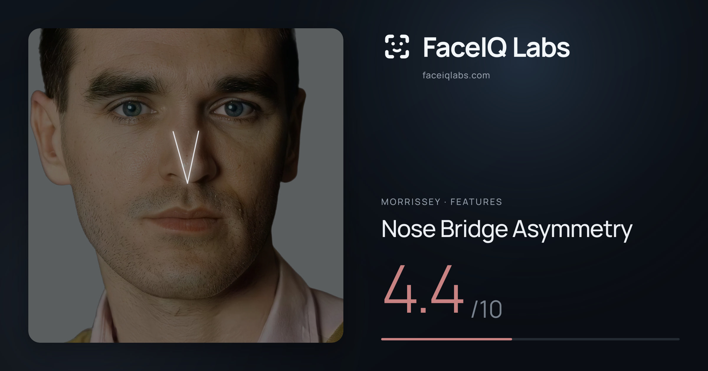Morrissey Nose Bridge Asymmetry: 4.4/10, drawn on the photo