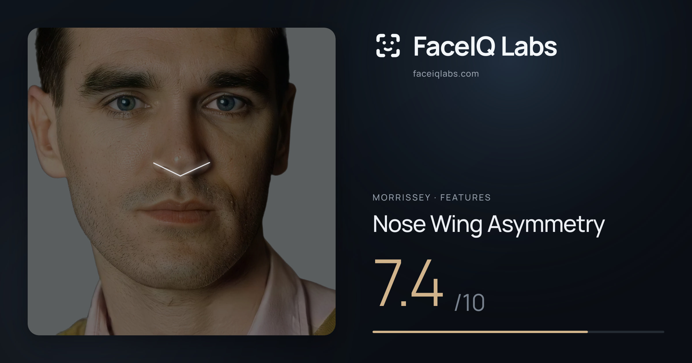 Morrissey Nose Wing Asymmetry: 7.4/10, drawn on the photo