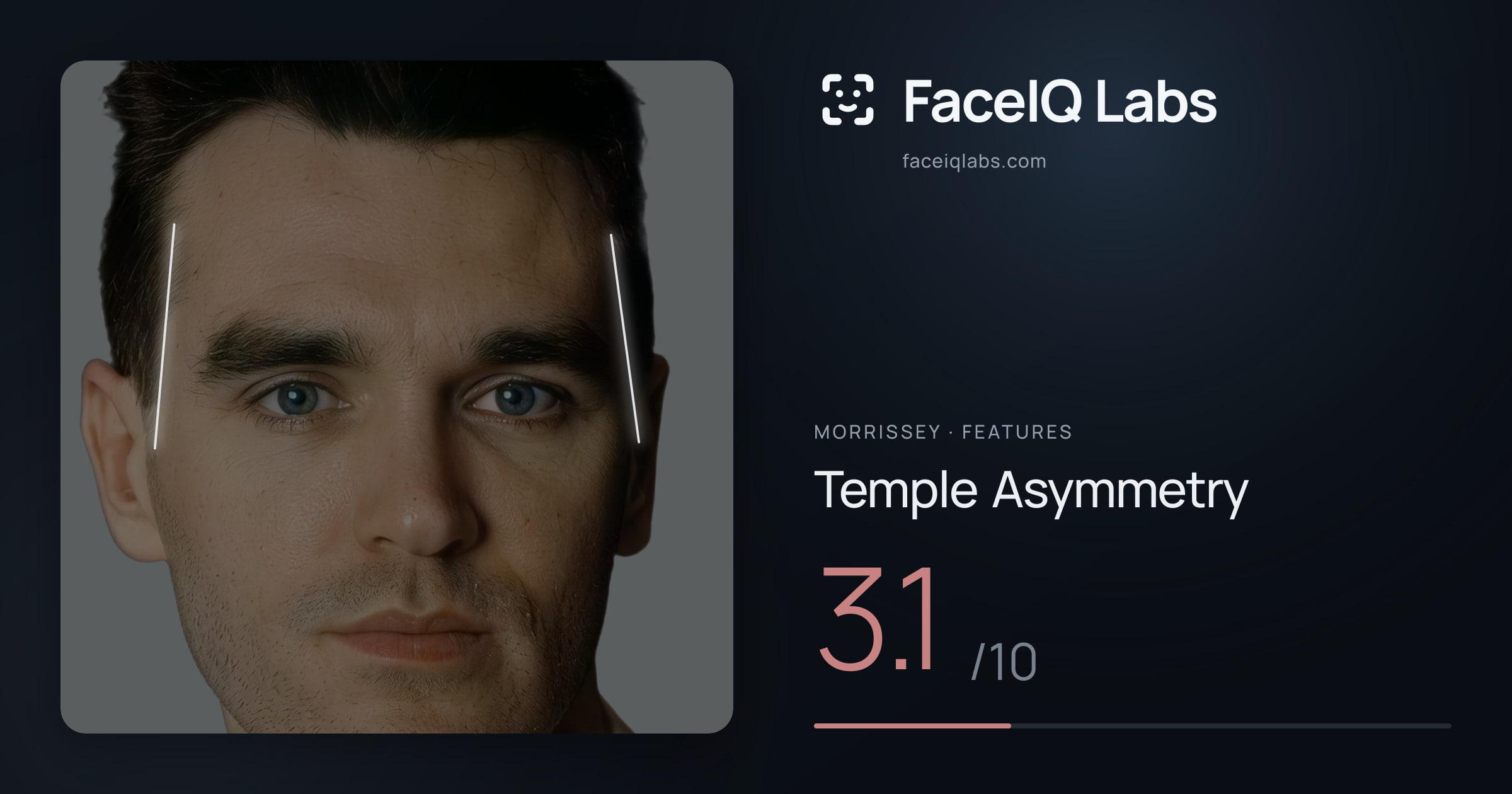 Morrissey Temple Asymmetry: 3.1/10, drawn on the photo