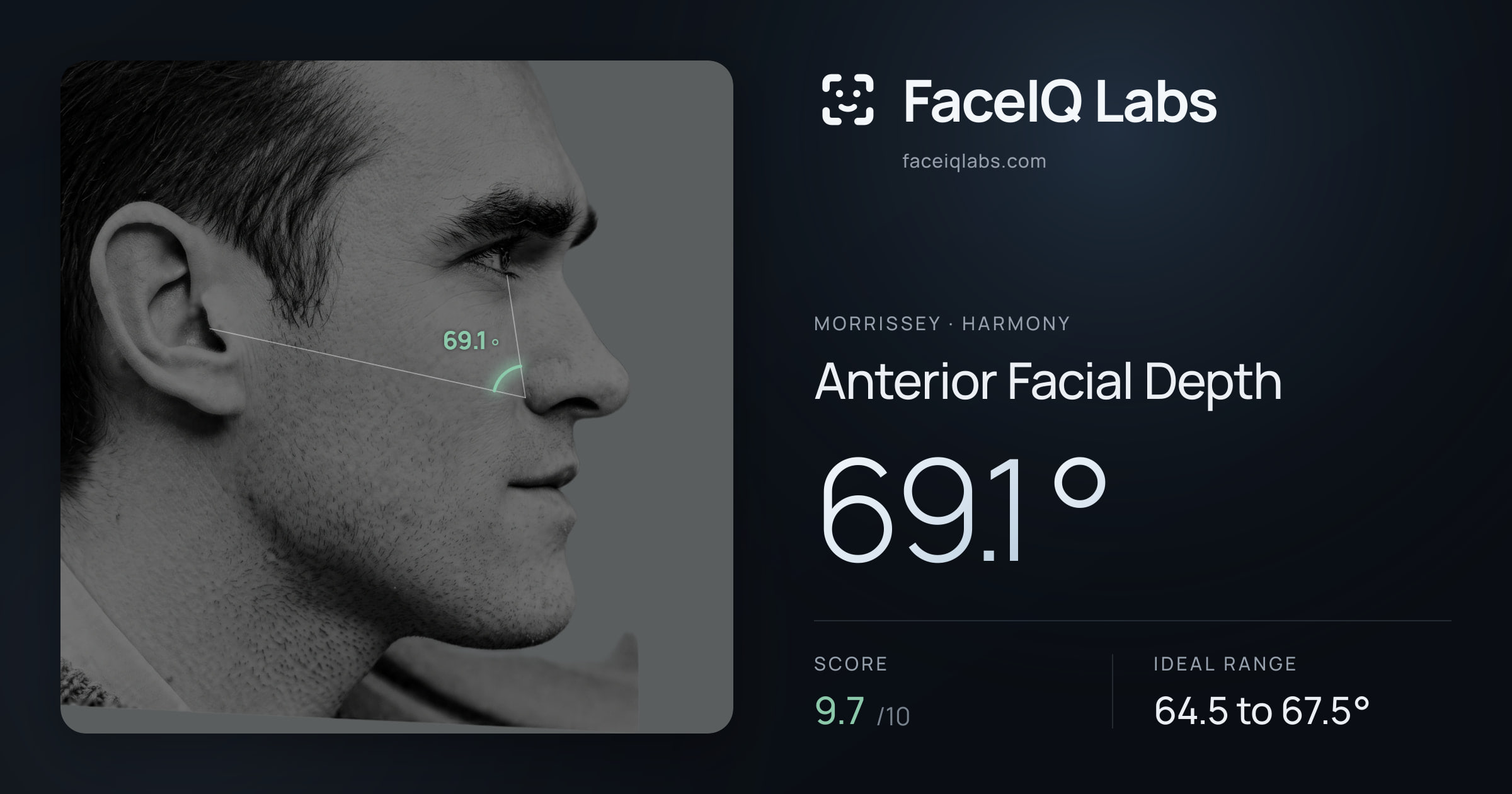 Morrissey Anterior Facial Depth: 69.1°, drawn on the photo