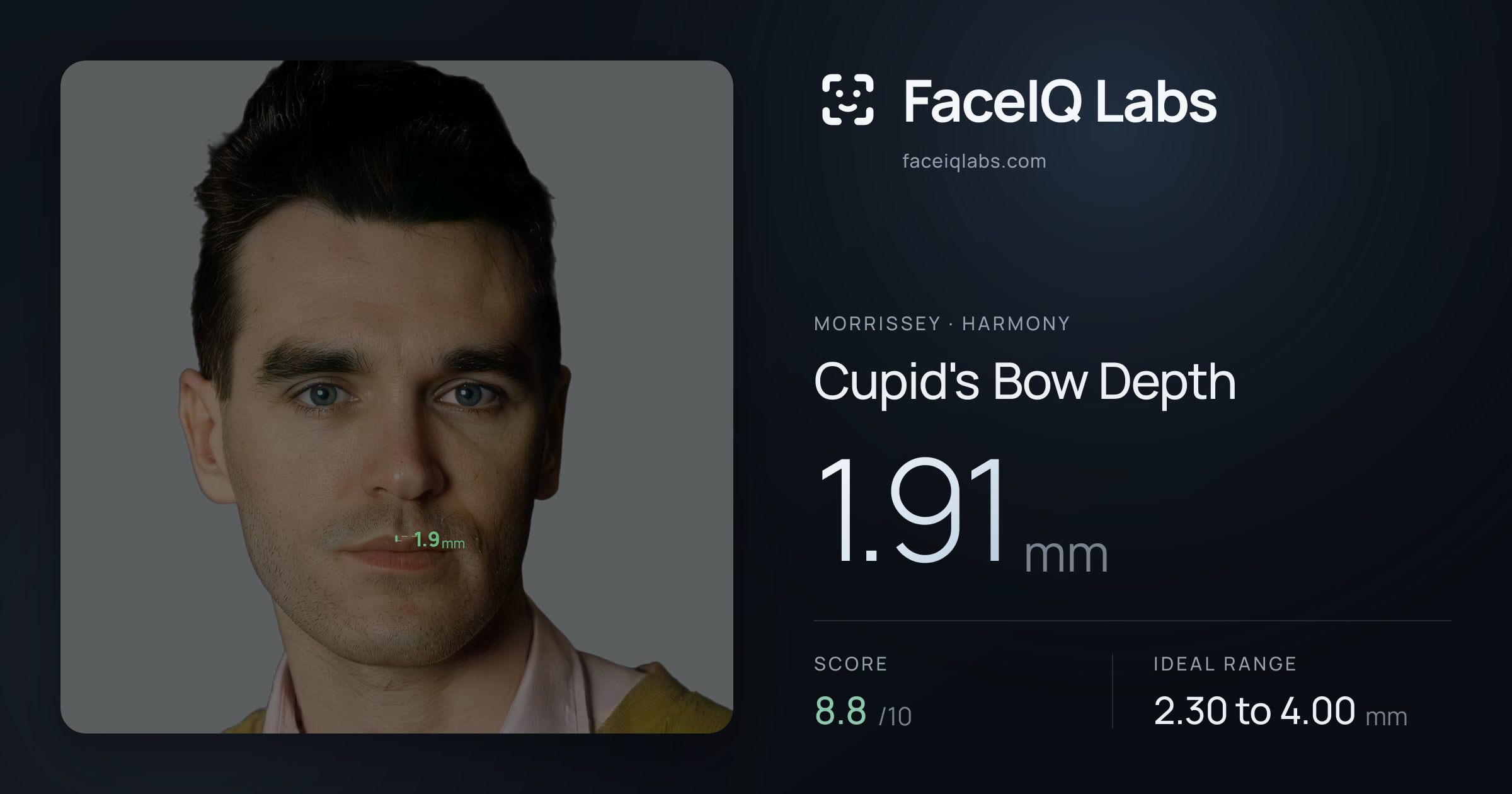 Morrissey Cupid's Bow Depth: 1.91mm, drawn on the photo