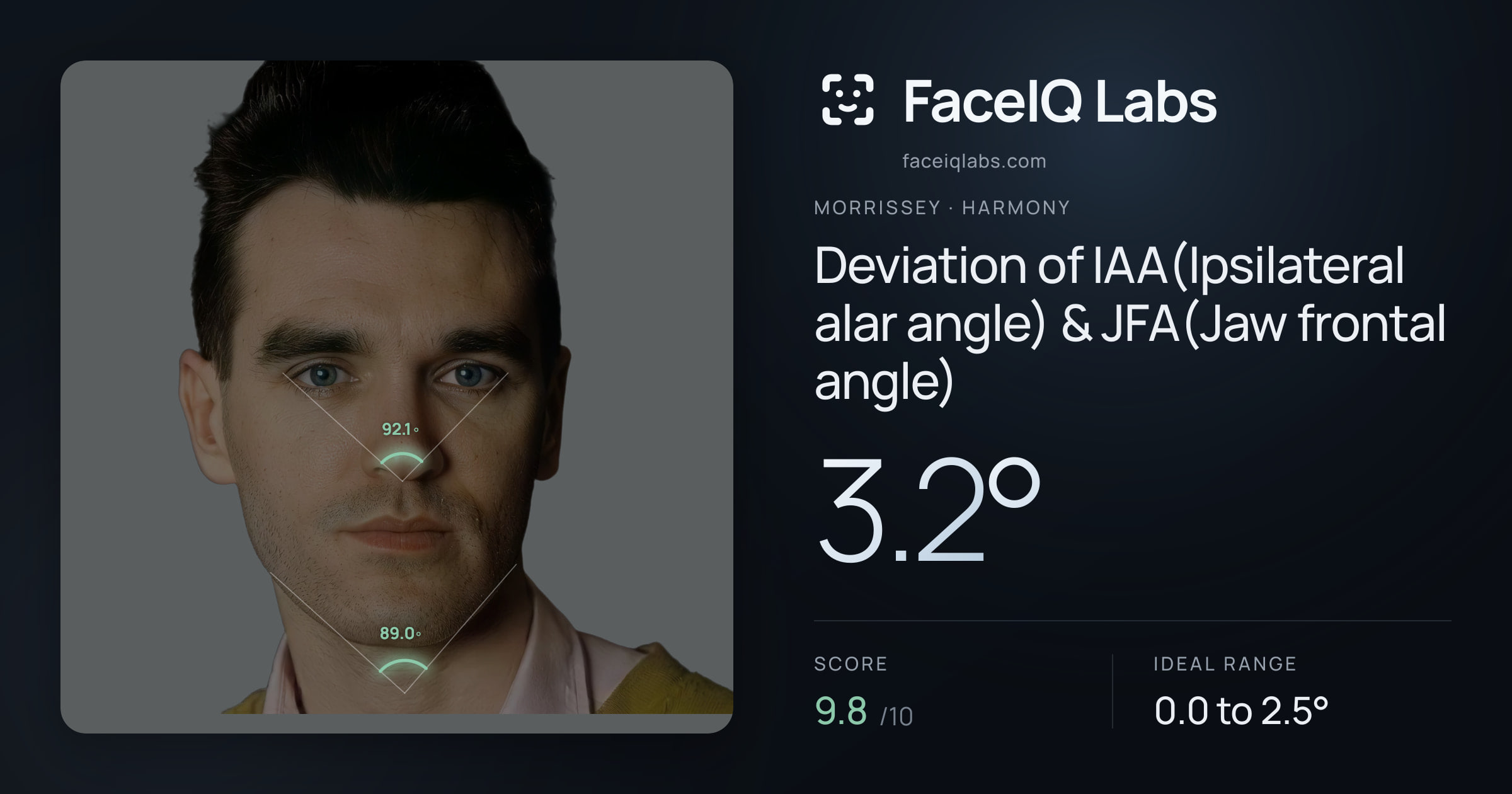 Morrissey Deviation of IAA(Ipsilateral alar angle) & JFA(Jaw frontal angle): 3.2°, drawn on the photo