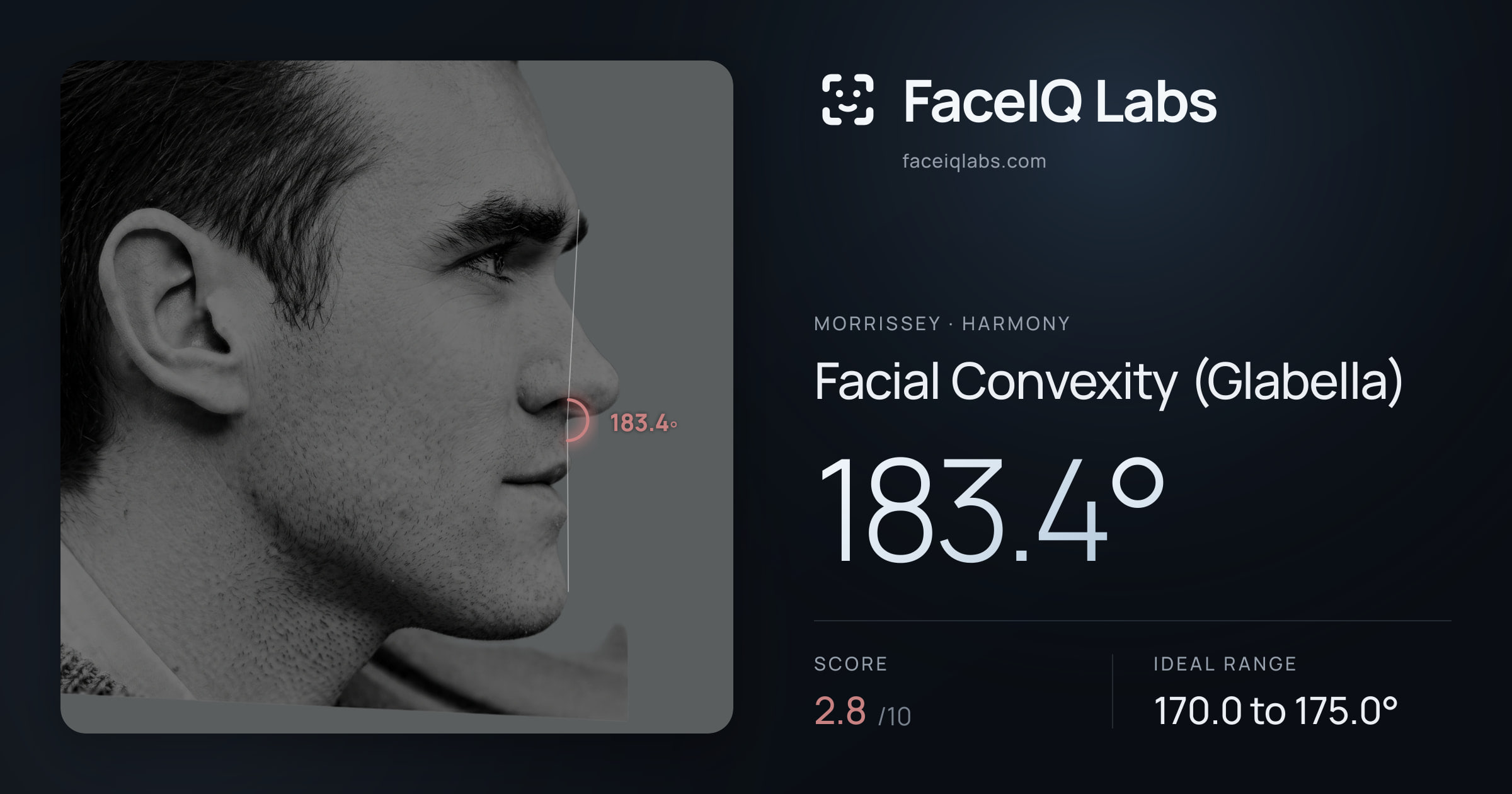 Morrissey Facial Convexity (Glabella): 183.4°, drawn on the photo