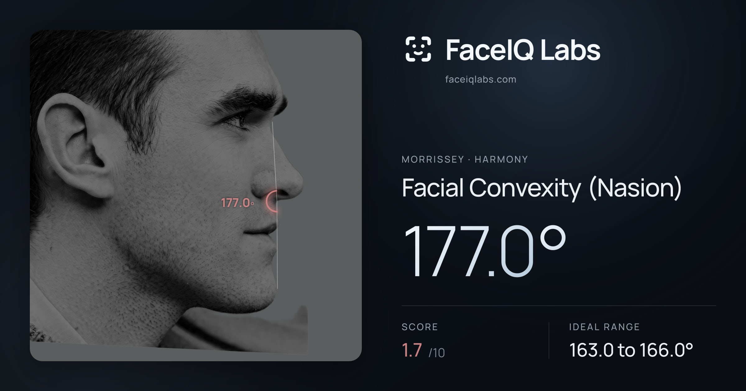Morrissey Facial Convexity (Nasion): 177.0°, drawn on the photo