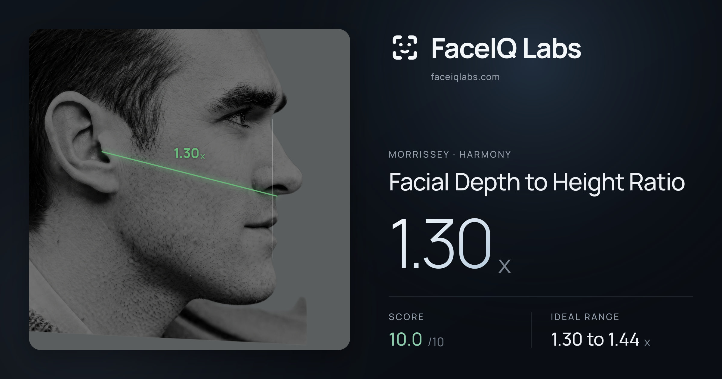Morrissey Facial Depth to Height Ratio: 1.30x, drawn on the photo