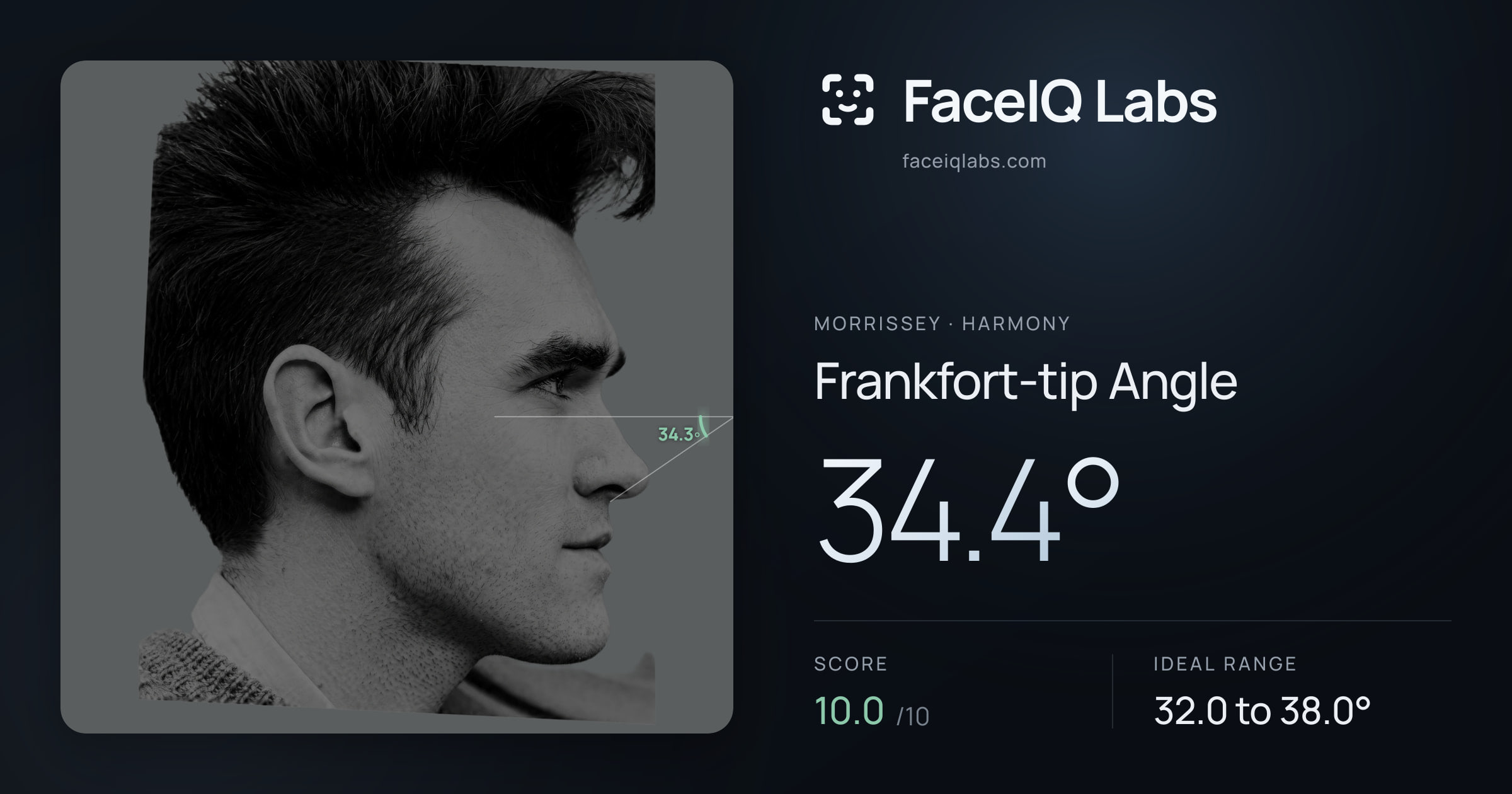Morrissey Frankfort-tip Angle: 34.4°, drawn on the photo