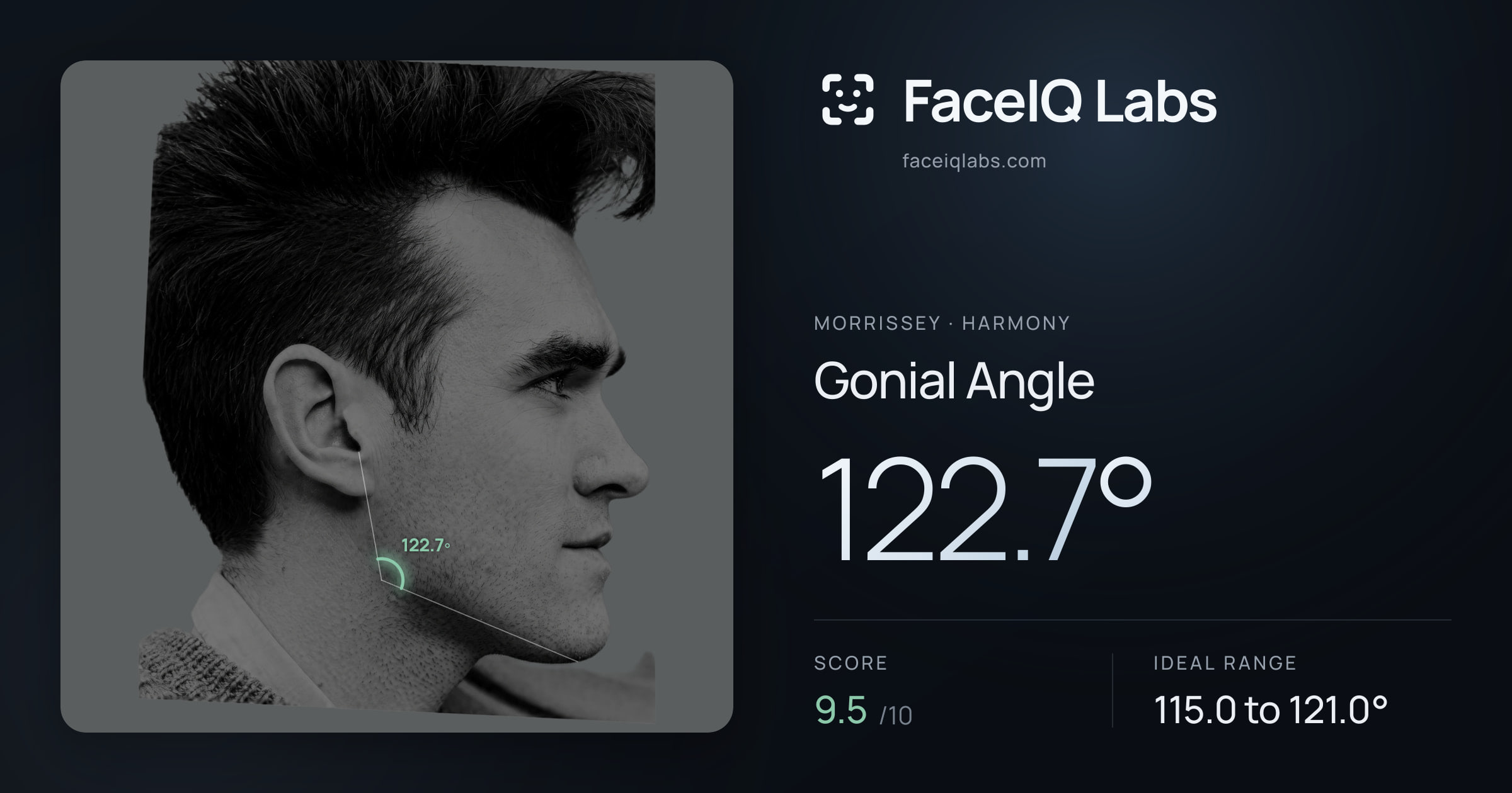 Morrissey Gonial Angle: 122.7°, drawn on the photo