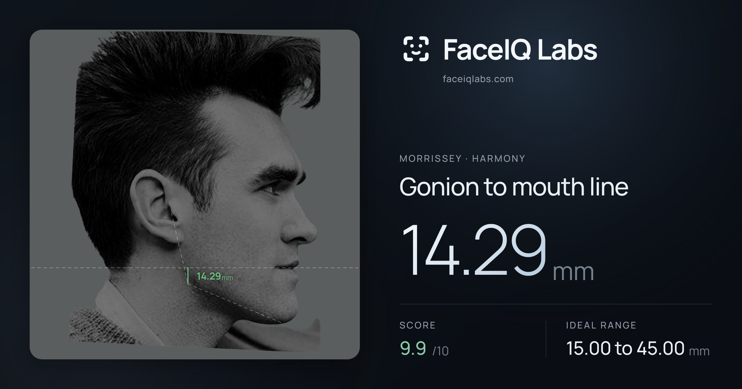 Morrissey Gonion to mouth line: 14.29mm, drawn on the photo
