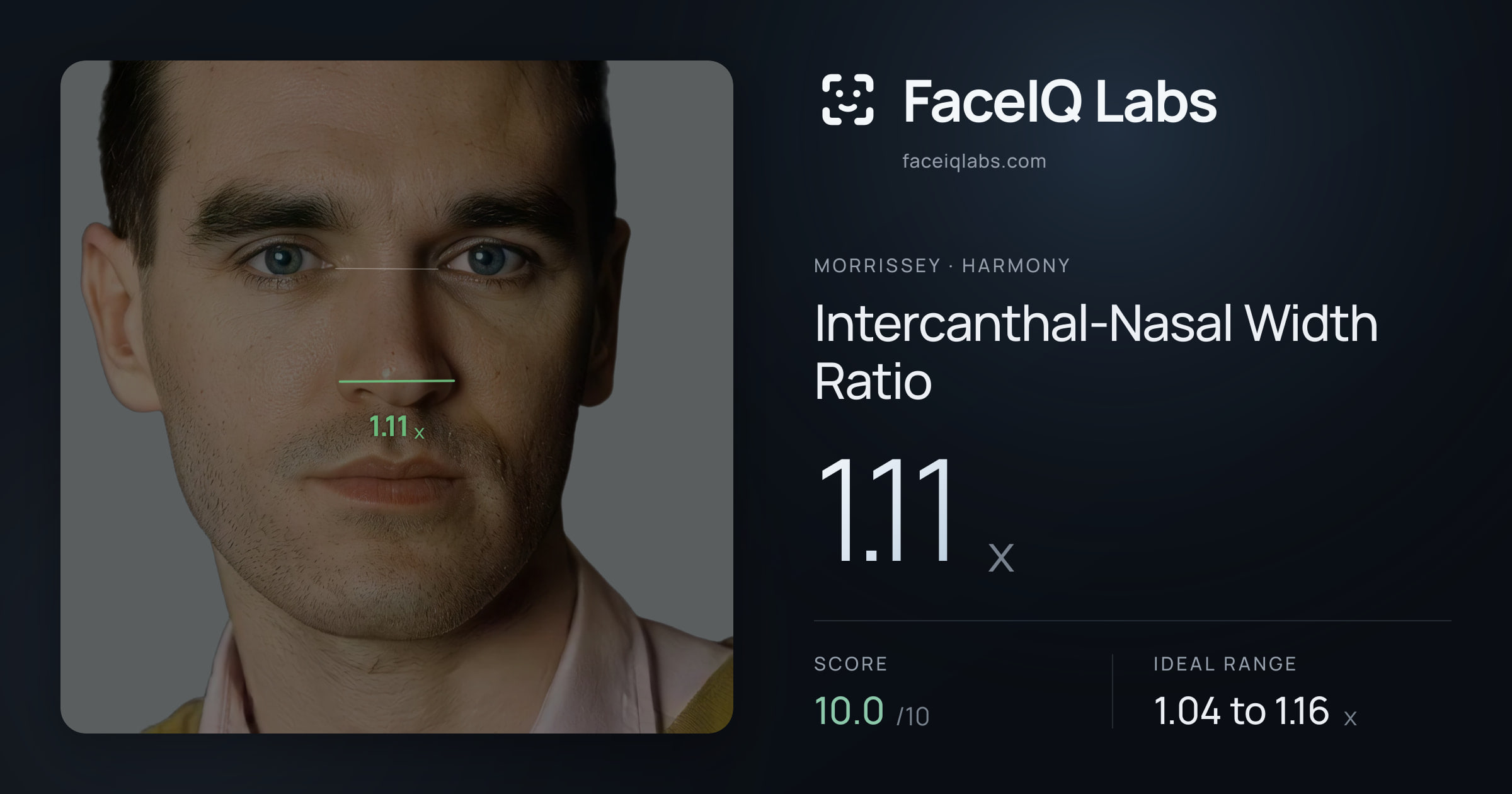 Morrissey Intercanthal-Nasal Width Ratio: 1.11x, drawn on the photo