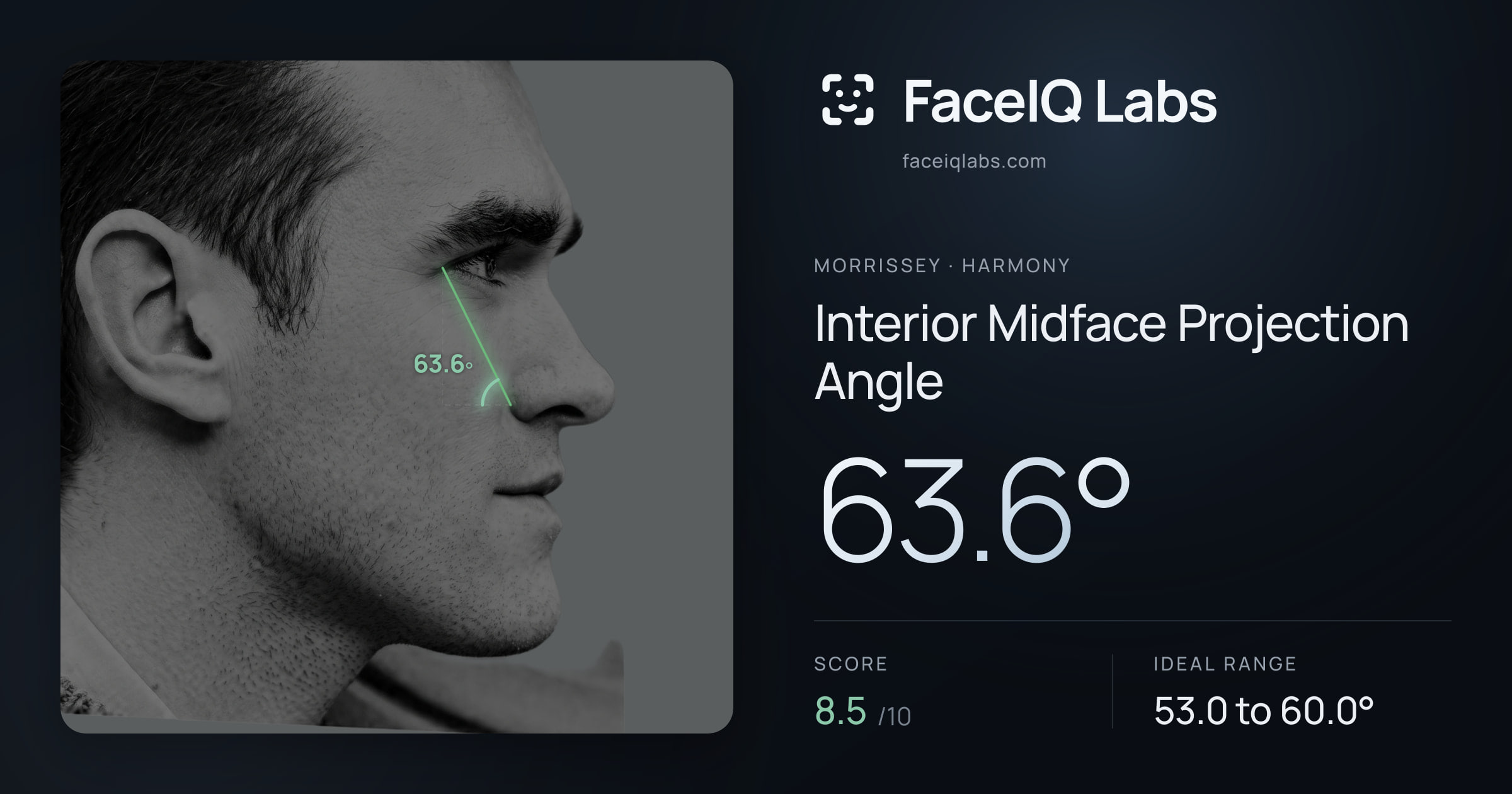 Morrissey Interior Midface Projection Angle: 63.6°, drawn on the photo