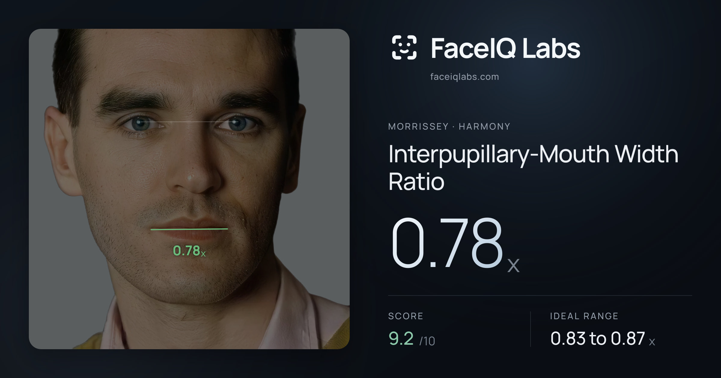 Morrissey Interpupillary-Mouth Width Ratio: 0.78x, drawn on the photo
