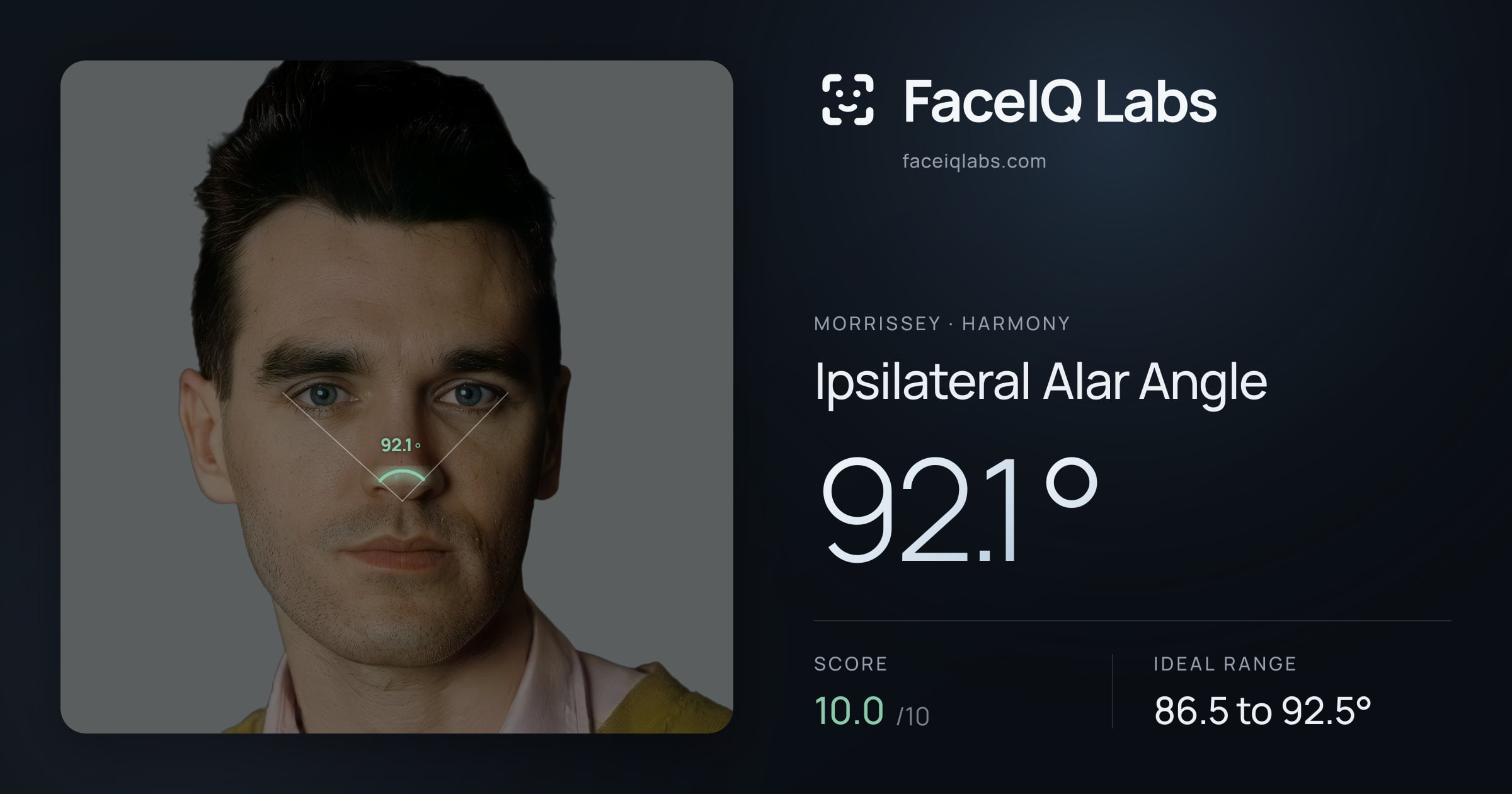 Morrissey Ipsilateral Alar Angle: 92.1°, drawn on the photo