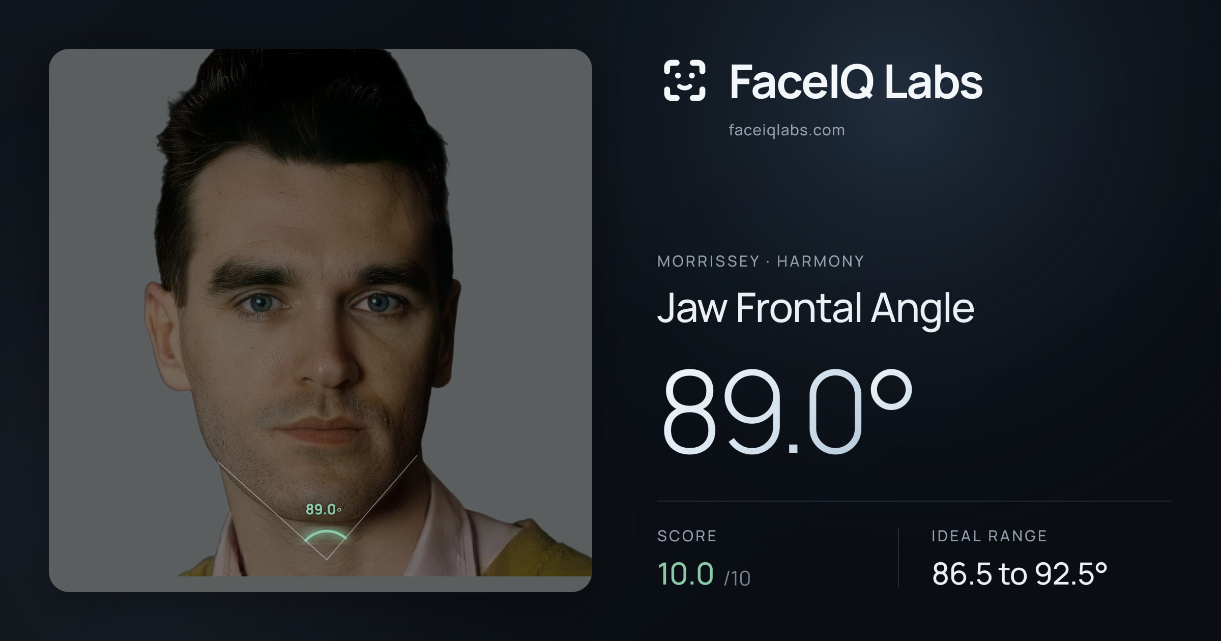 Morrissey Jaw Frontal Angle: 89.0°, drawn on the photo