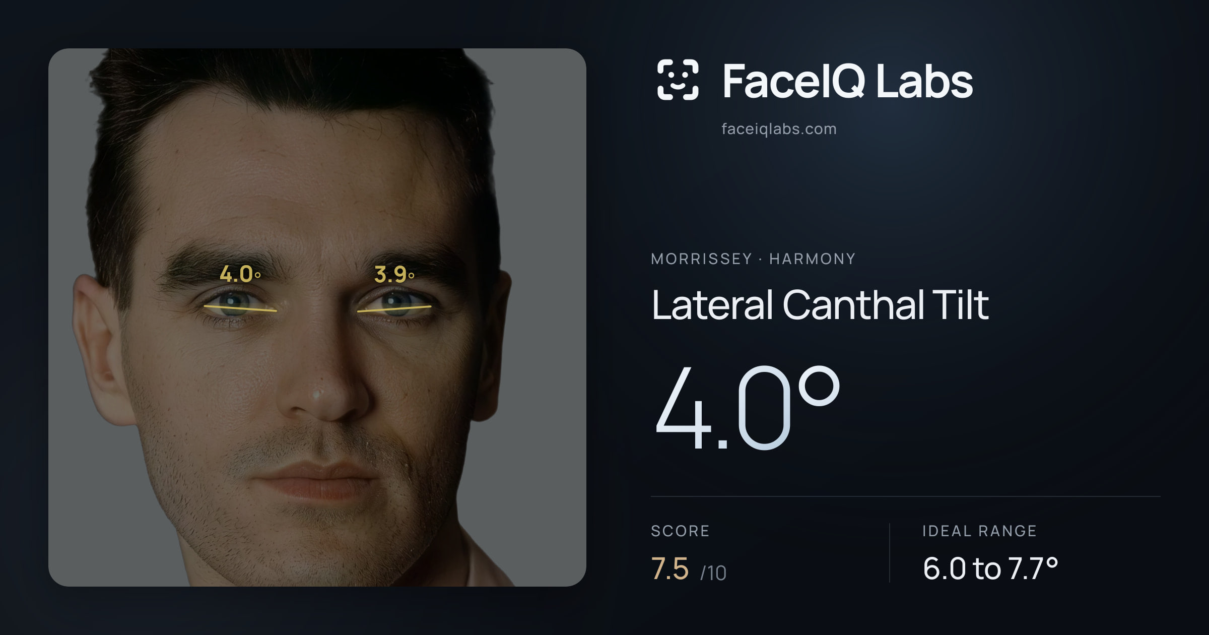 Morrissey Lateral Canthal Tilt: 4.0°, drawn on the photo
