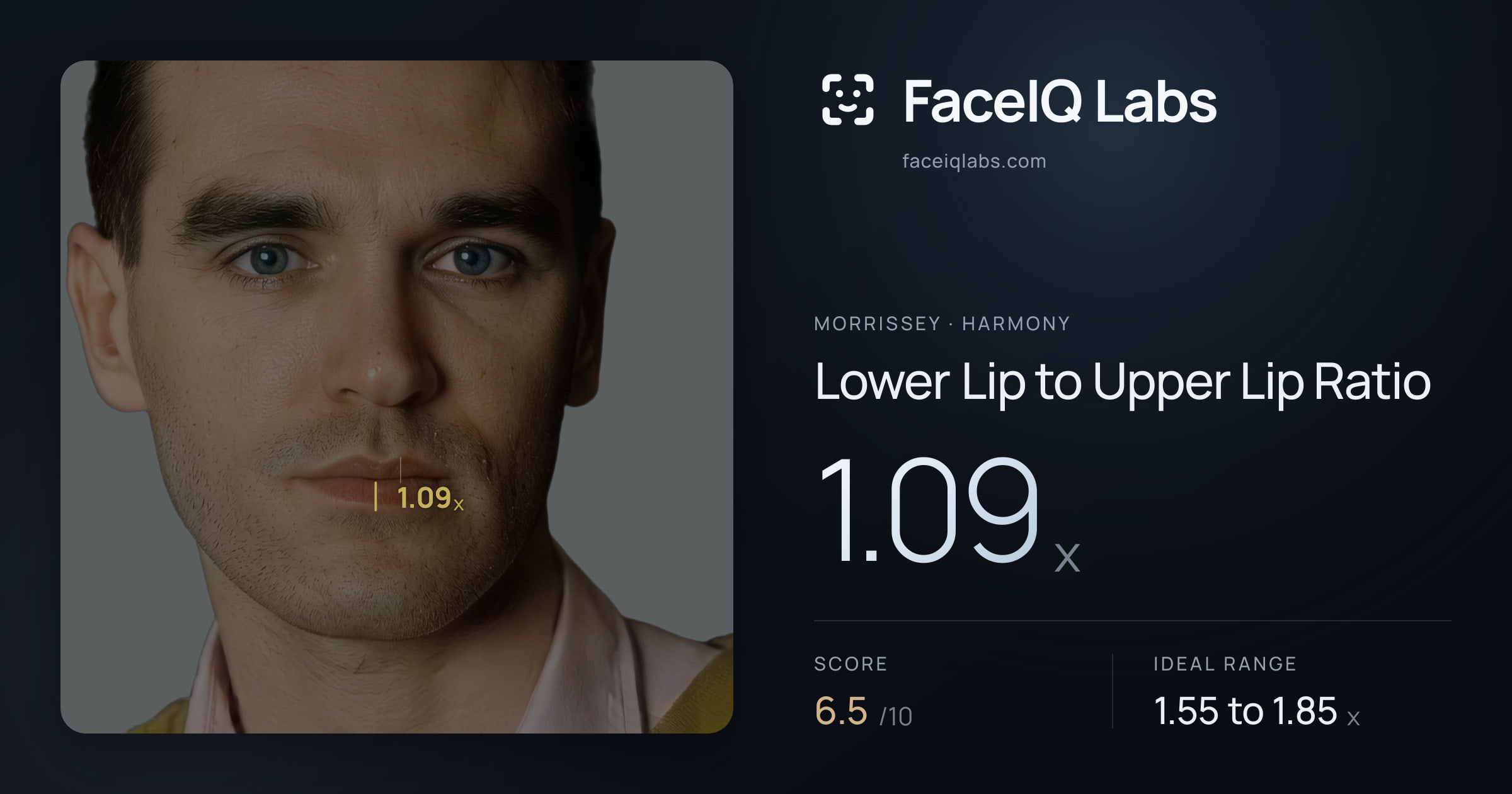 Morrissey Lower Lip to Upper Lip Ratio: 1.09x, drawn on the photo