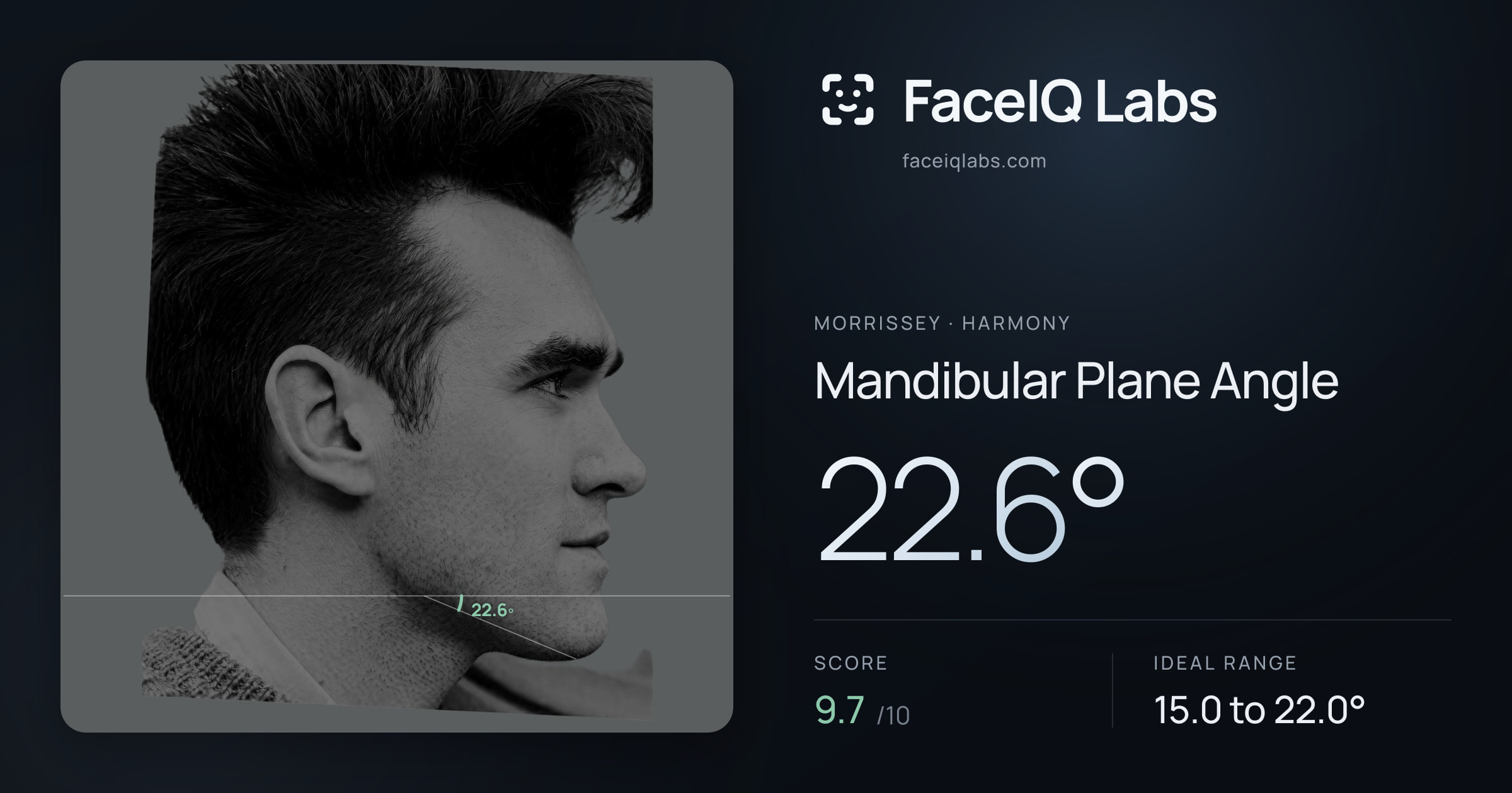 Morrissey Mandibular Plane Angle: 22.6°, drawn on the photo