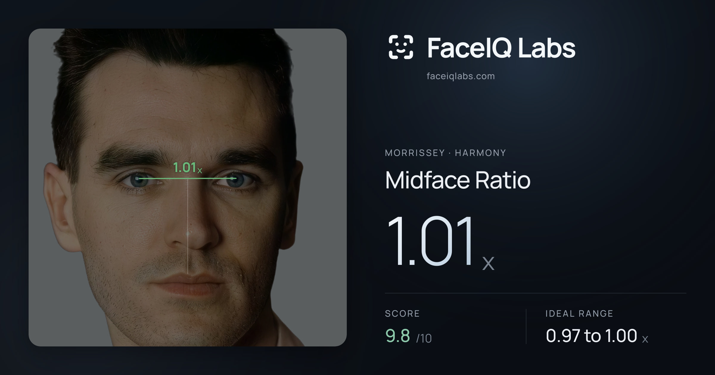 Morrissey Midface Ratio: 1.01x, drawn on the photo