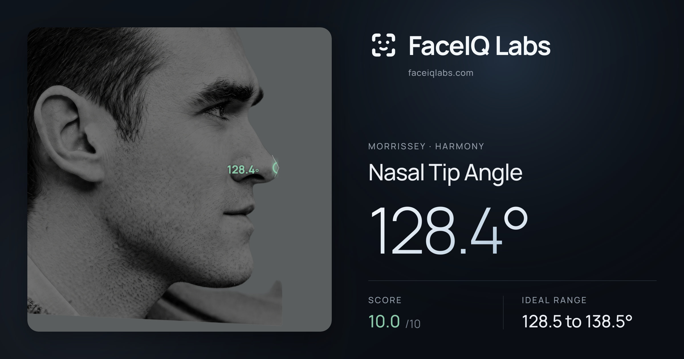 Morrissey Nasal Tip Angle: 128.4°, drawn on the photo