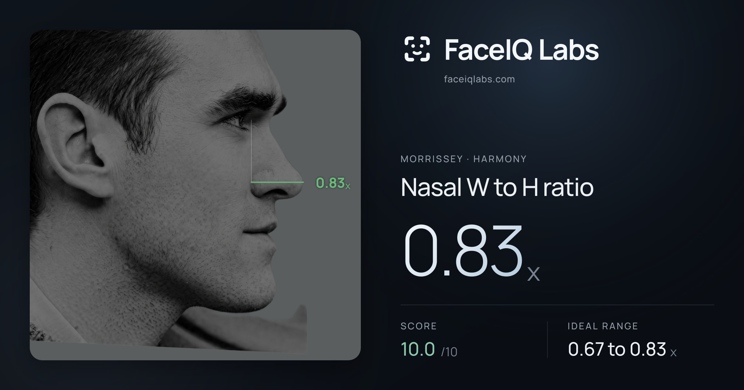 Morrissey Nasal W to H ratio: 0.83x, drawn on the photo