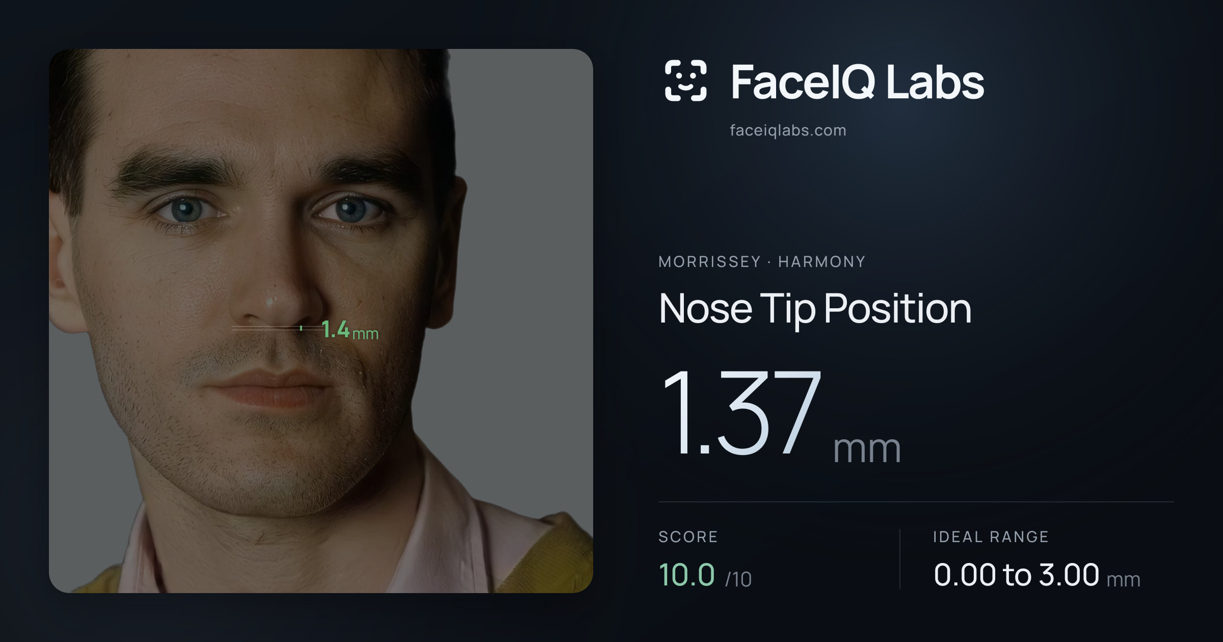Morrissey Nose Tip Position: 1.37mm, drawn on the photo