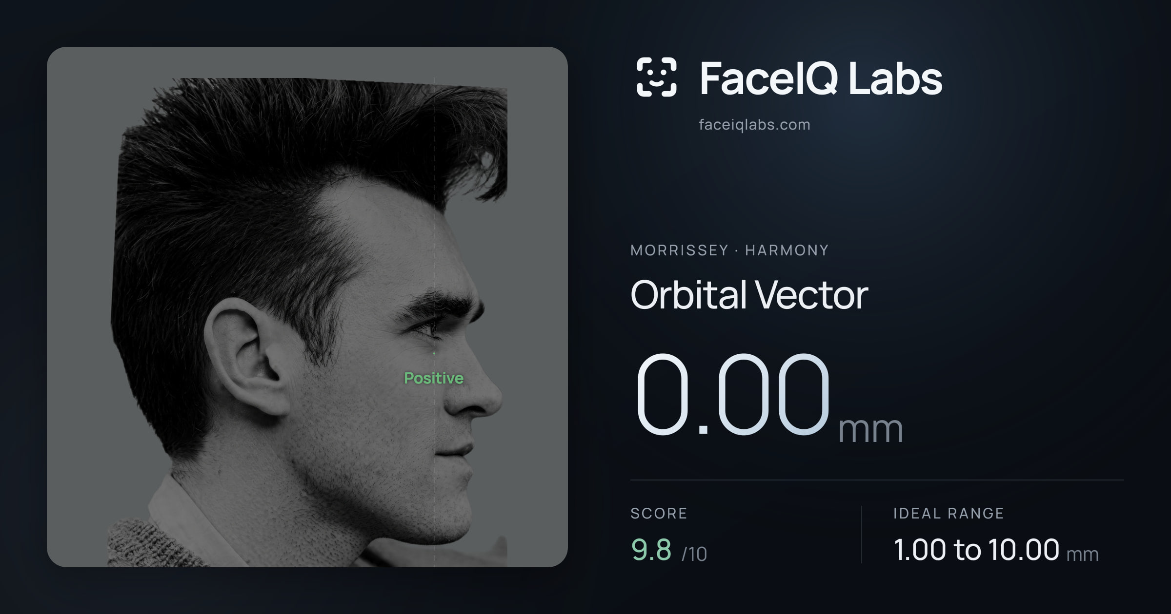 Morrissey Orbital Vector: 0.00mm, drawn on the photo