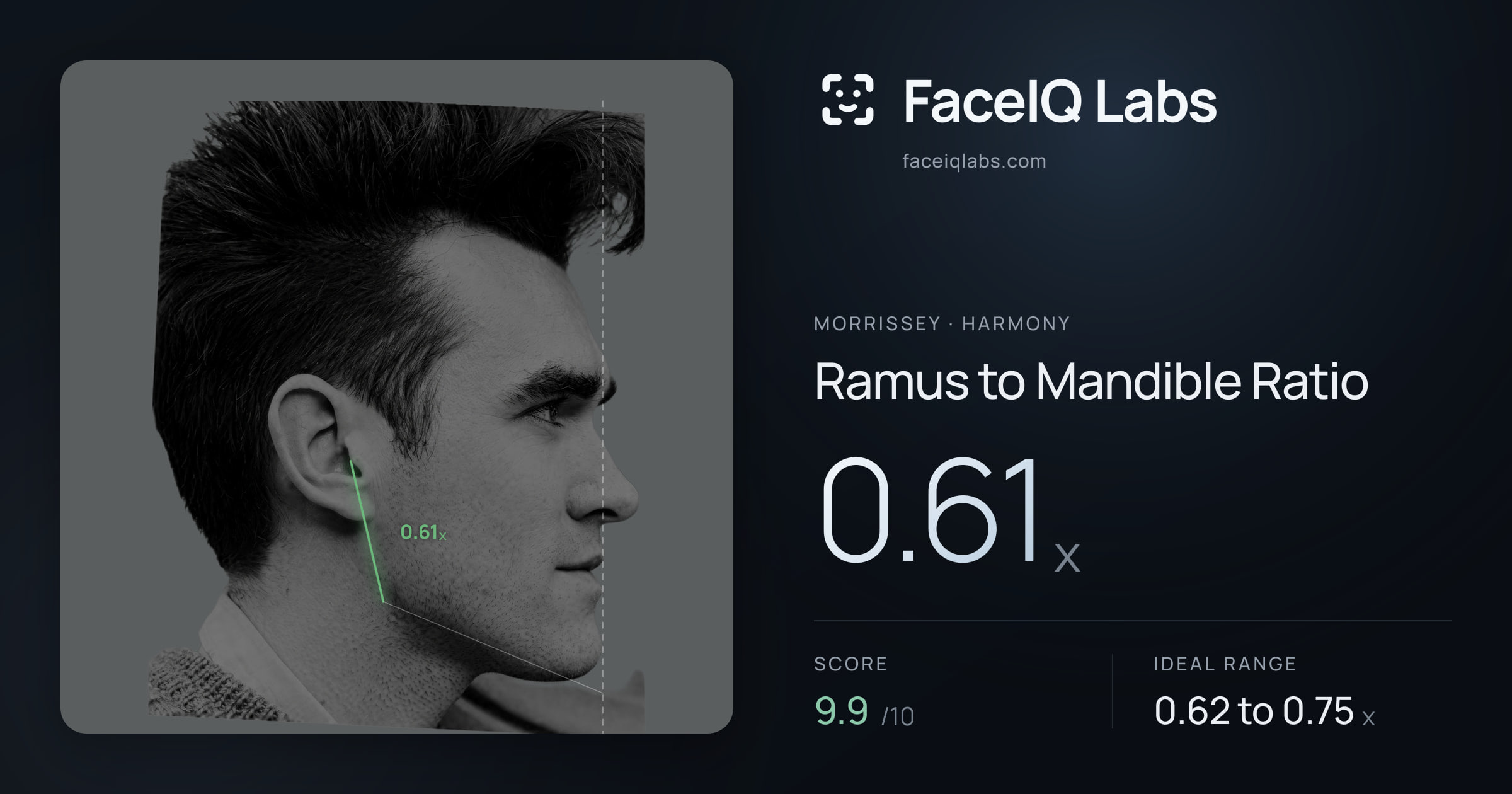 Morrissey Ramus to Mandible Ratio: 0.61x, drawn on the photo