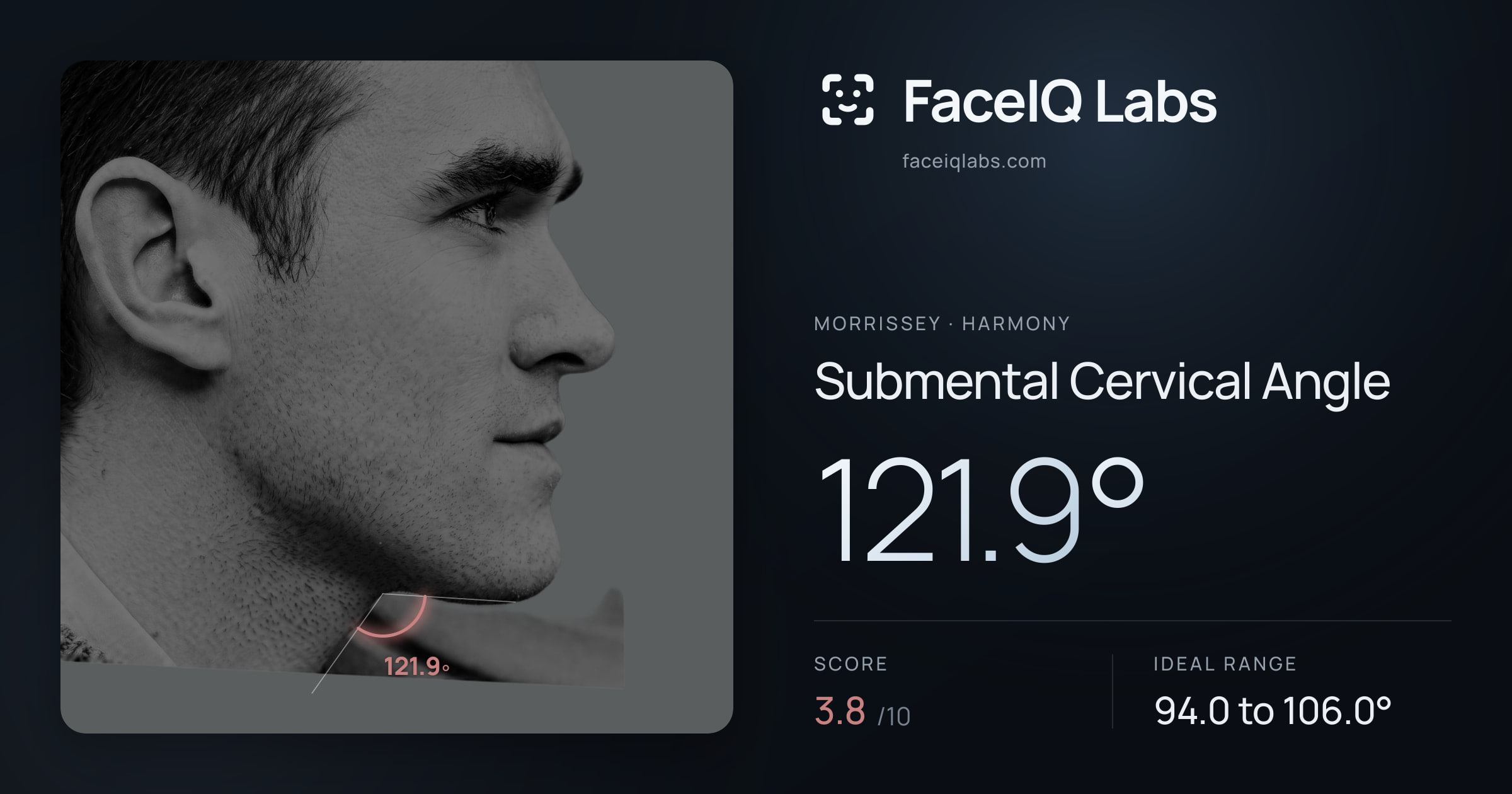 Morrissey Submental Cervical Angle: 121.9°, drawn on the photo